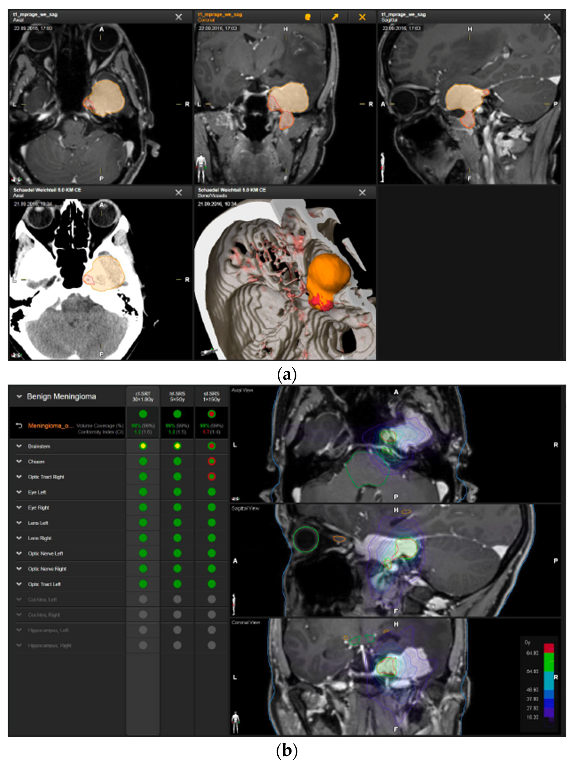 Brainsci 12 01326 g003a