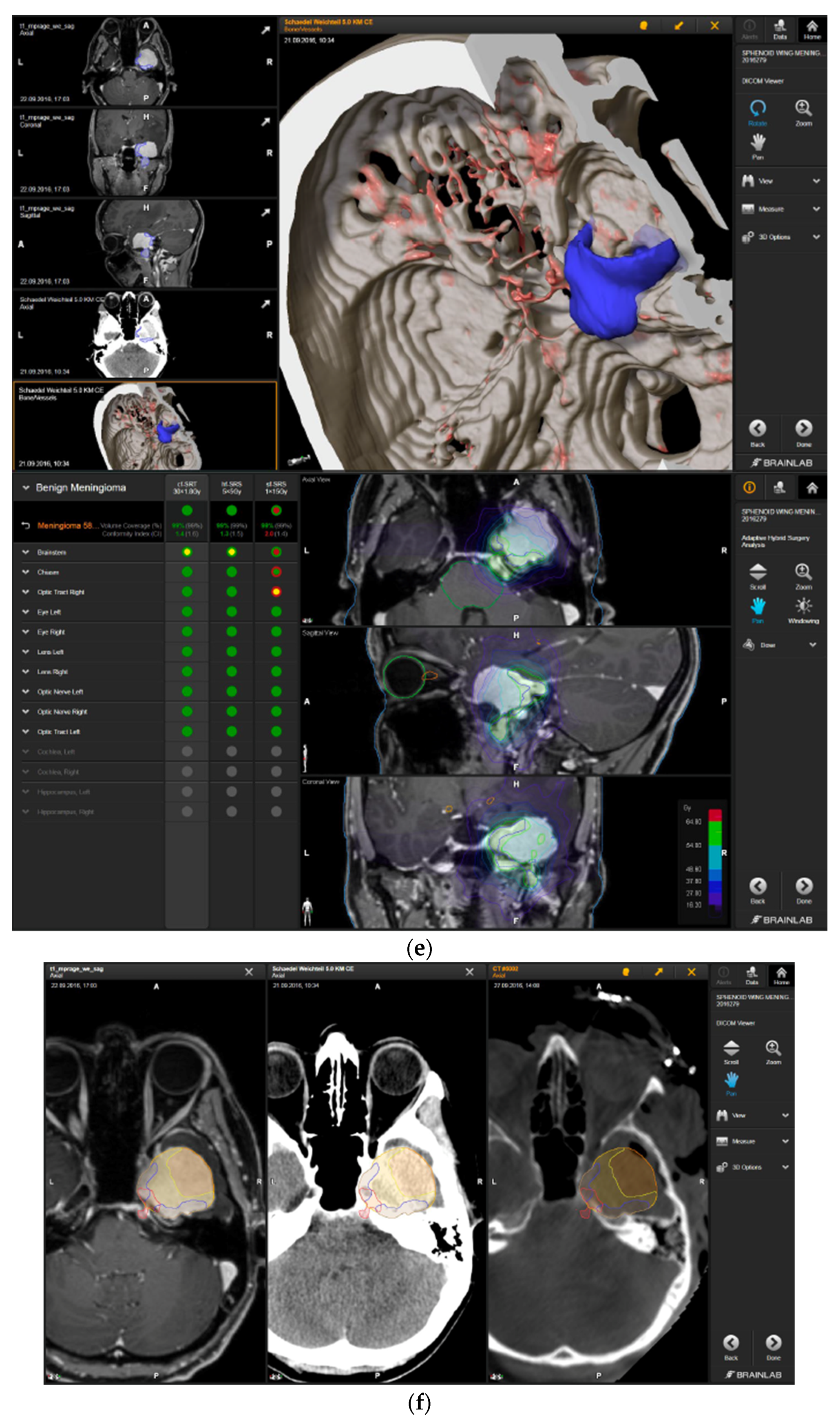 Brainsci 12 01326 g003c