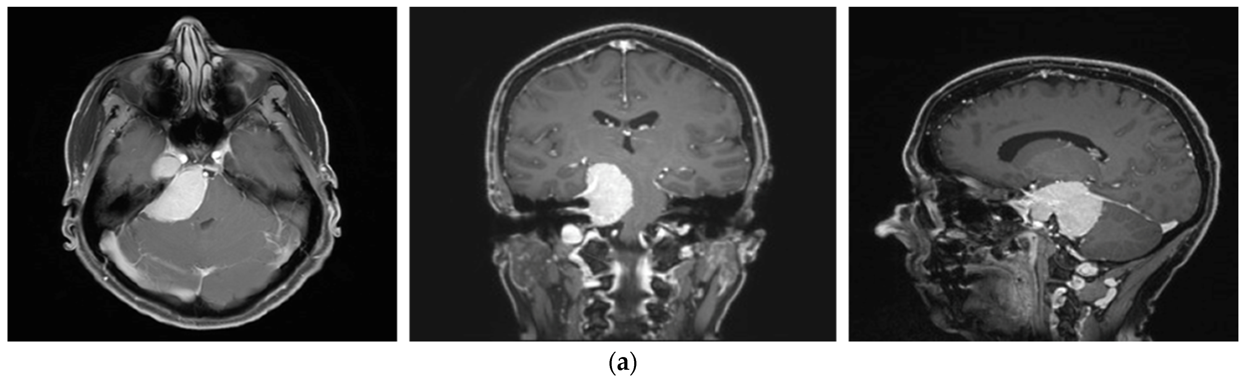 Brainsci 12 01326 g004a