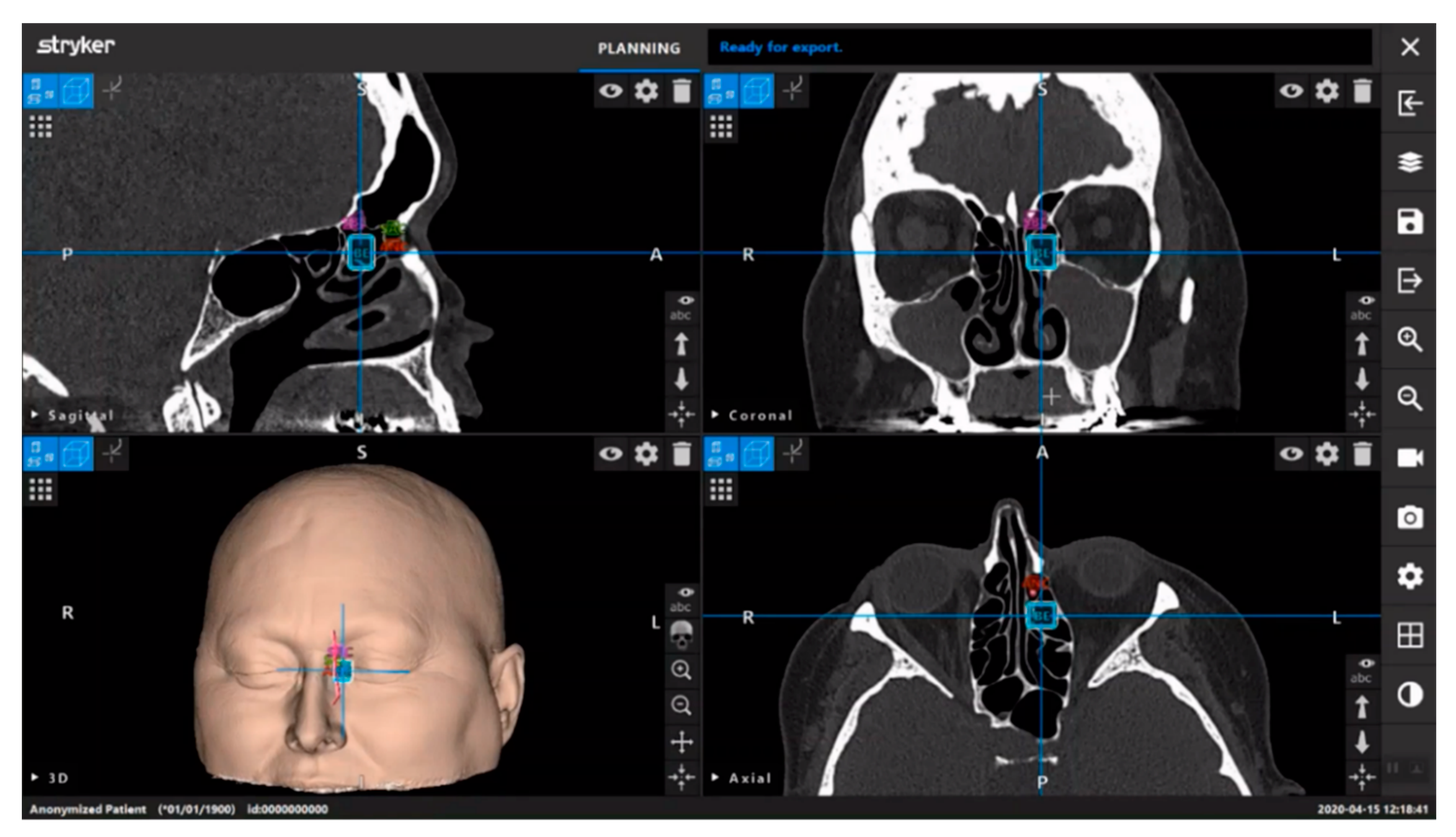 Brainsci 12 01337 g004 Brainsci 12 01337 g004