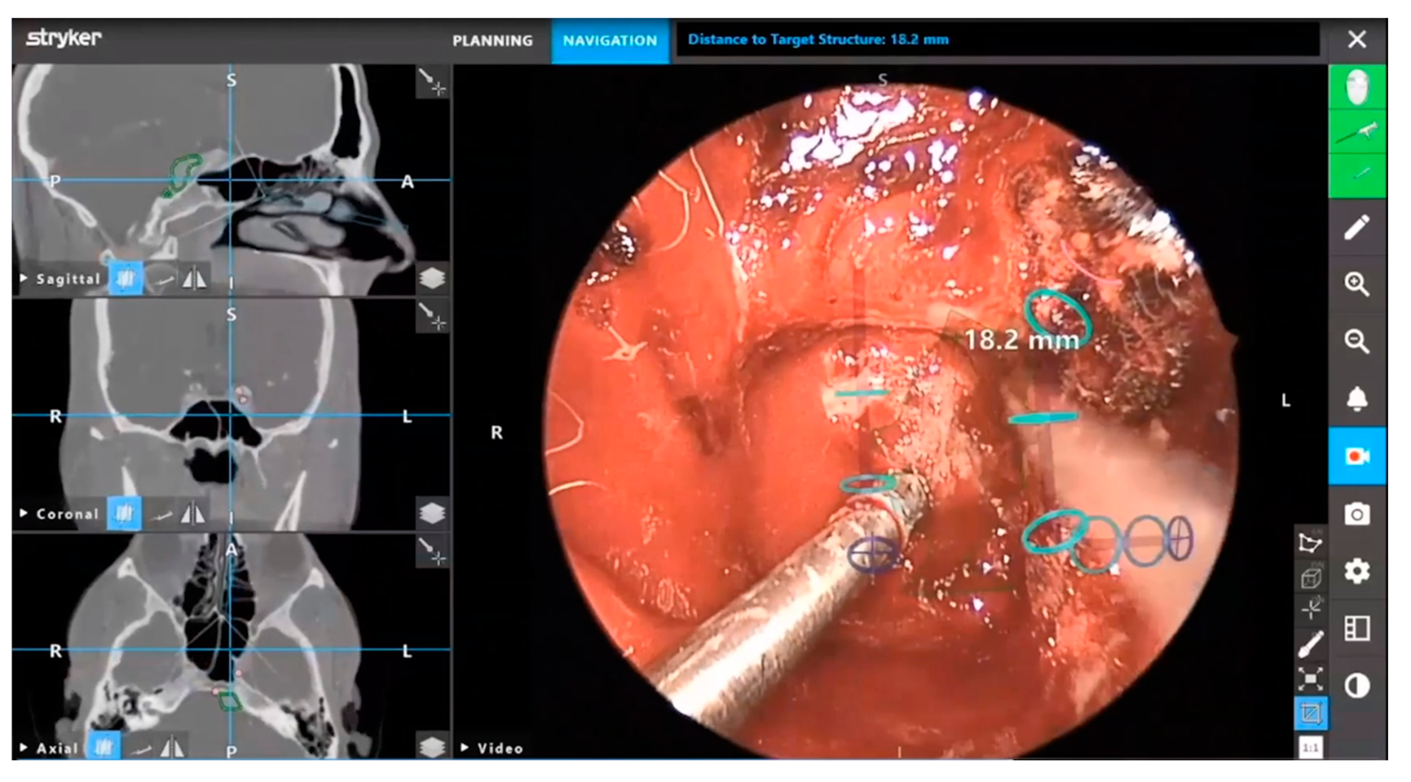 Brainsci 12 01337 g006 Brainsci 12 01337 g006
