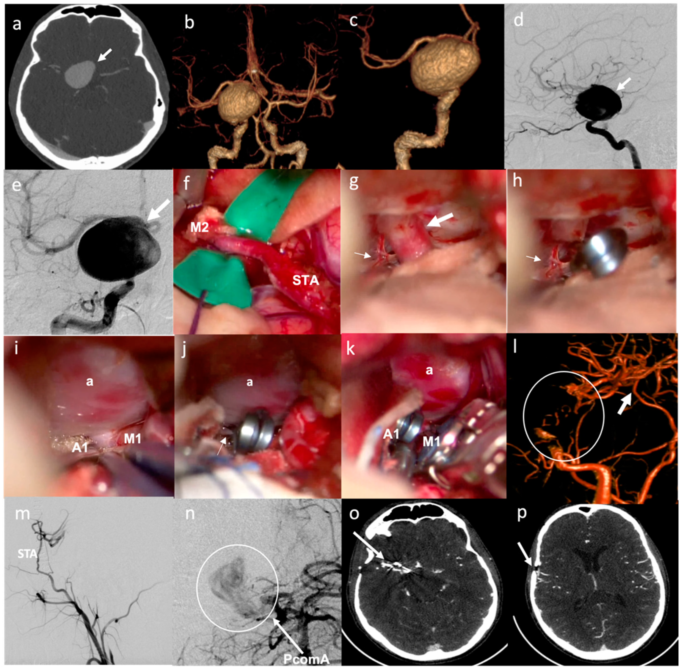 Brainsci 12 01339 g003