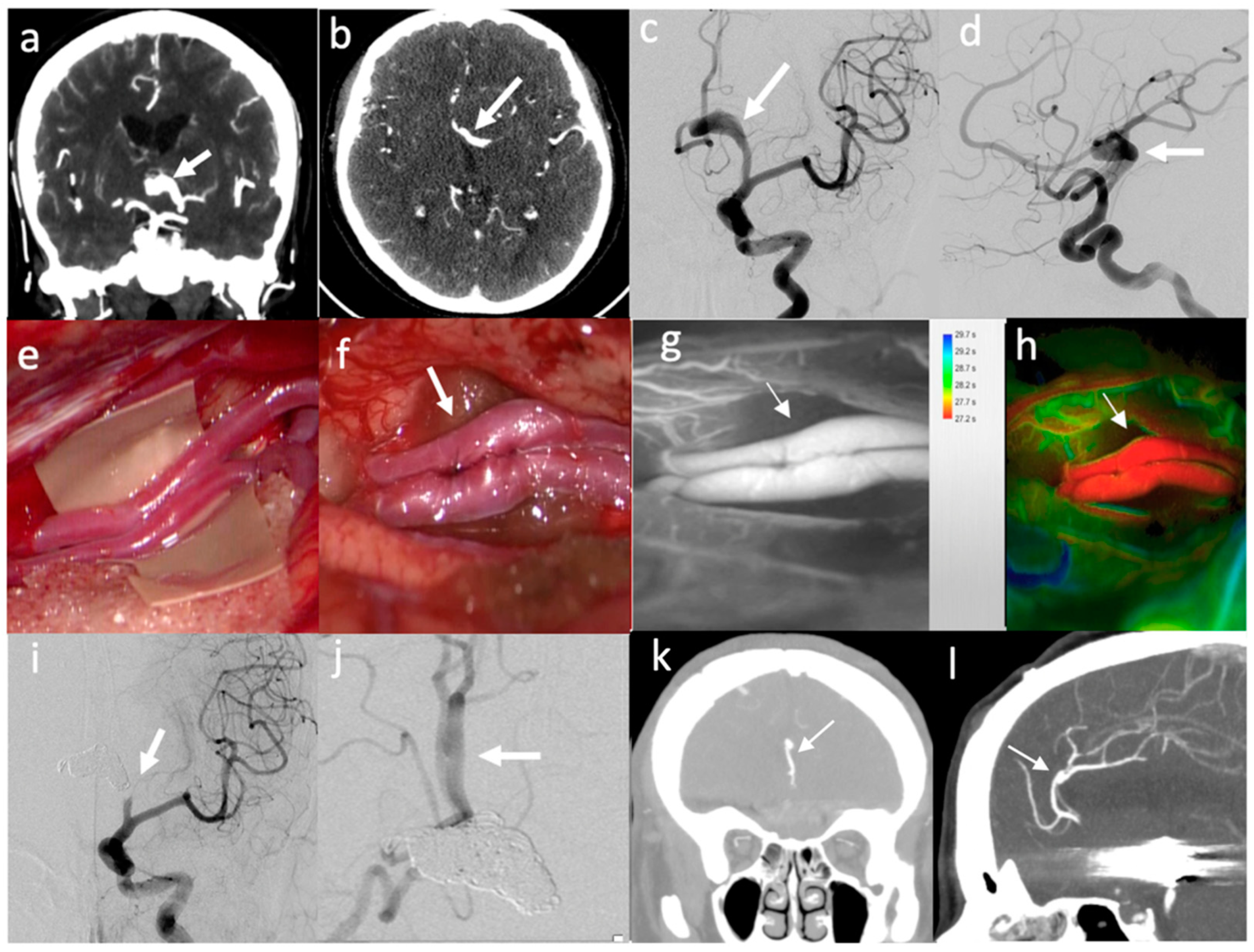 Brainsci 12 01339 g004