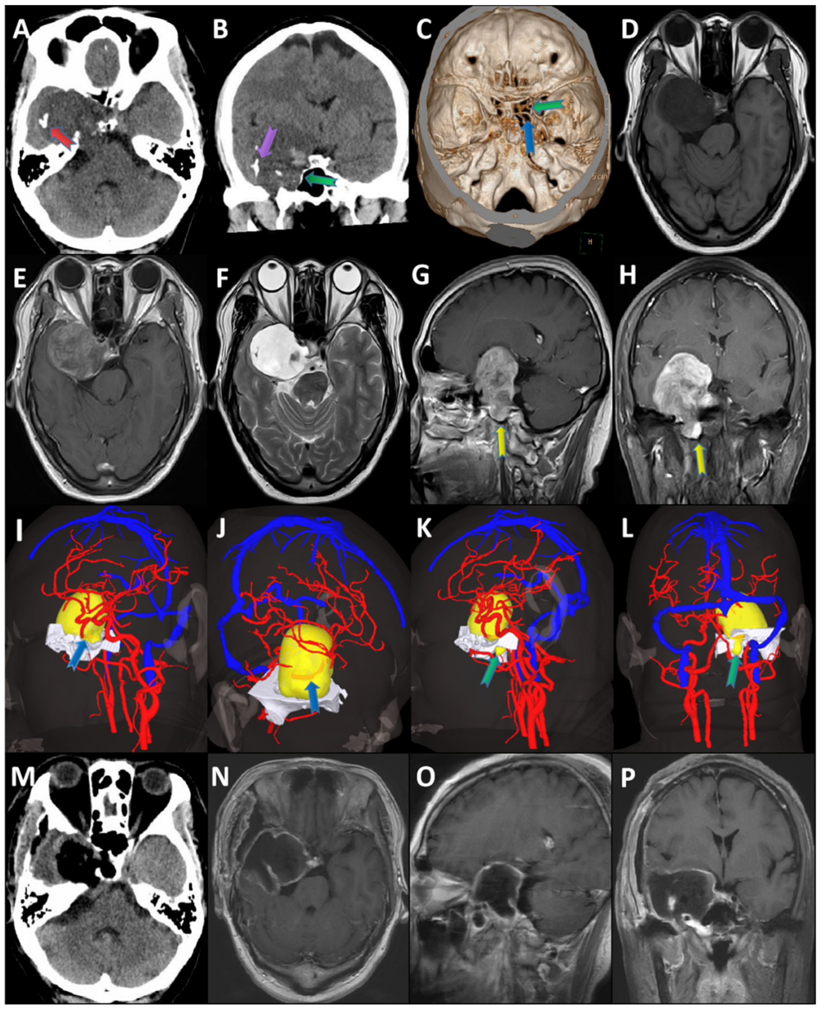 Brainsci 12 01353 g002