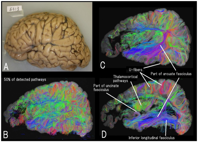 Brainsci 12 01366 g002 Brainsci 12 01366 g002