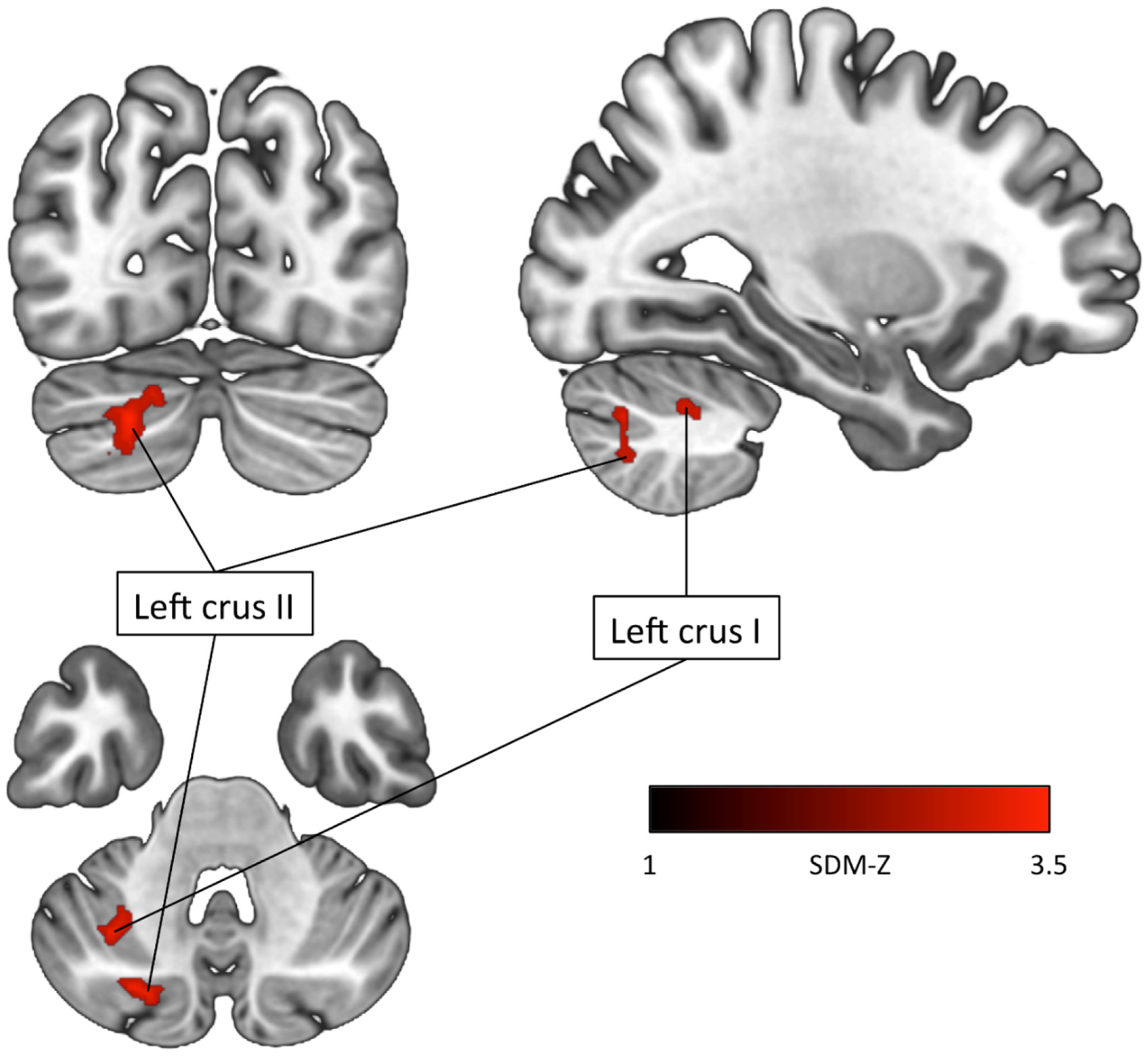 Brainsci 12 01367 g001