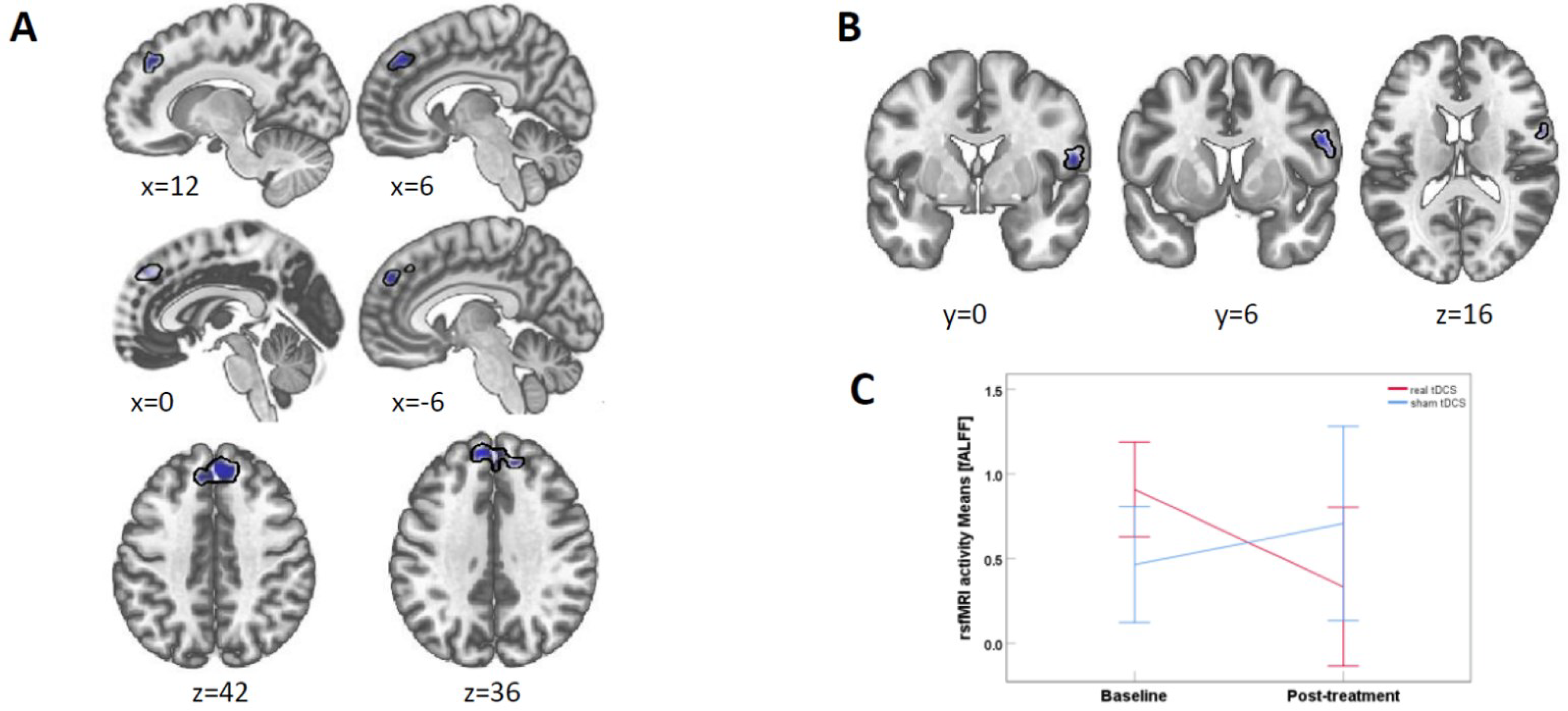Brainsci 12 01382 g003 Brainsci 12 01382 g003