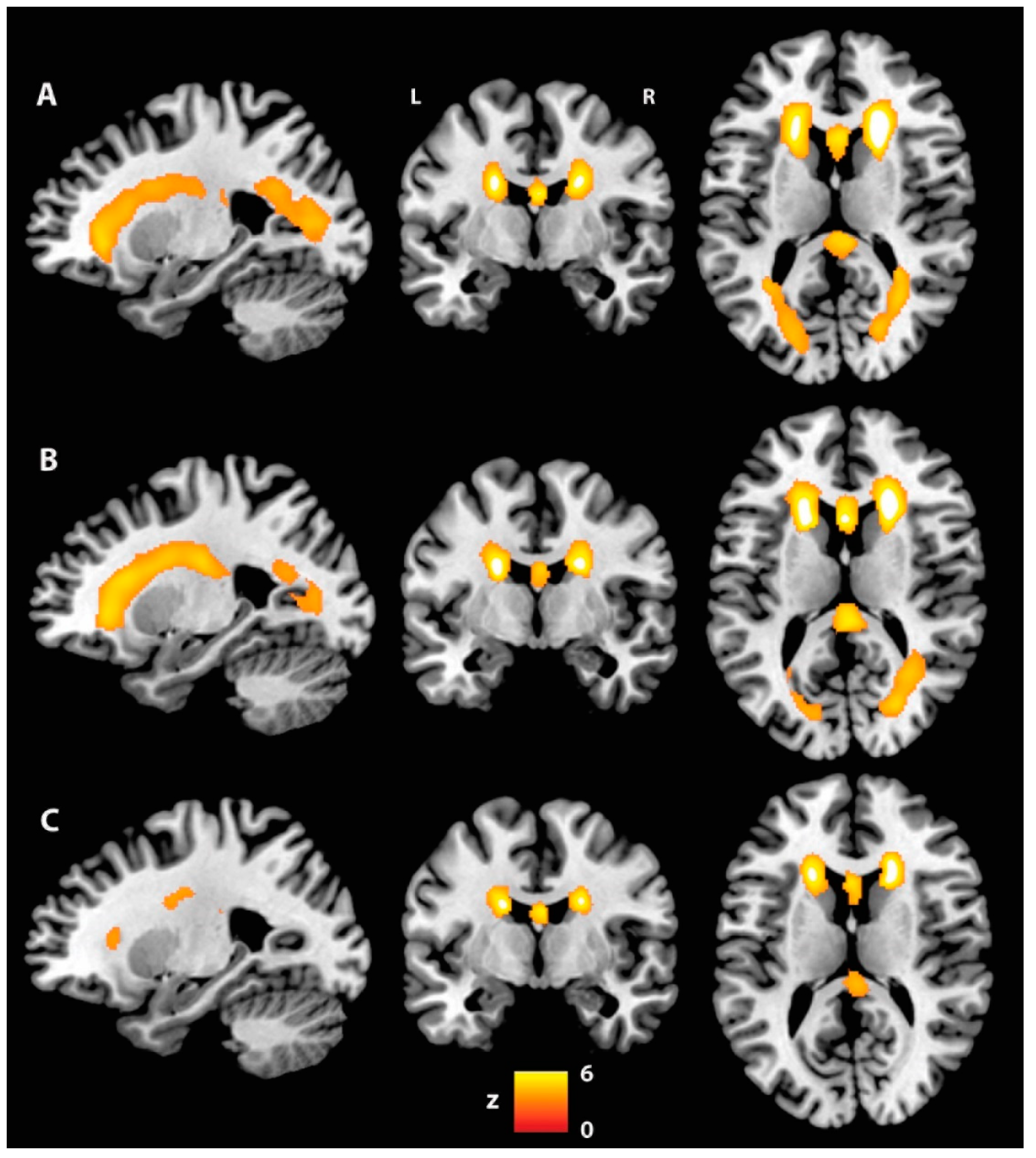 Brainsci 12 01383 g002 Brainsci 12 01383 g002