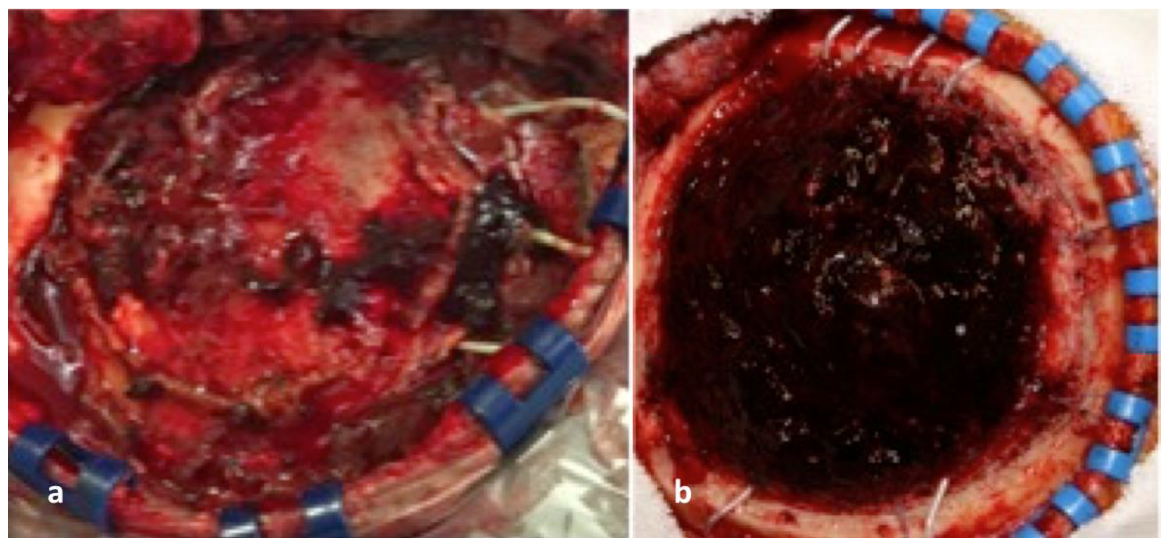 Brainsci 12 01434 g003 Brainsci 12 01434 g003