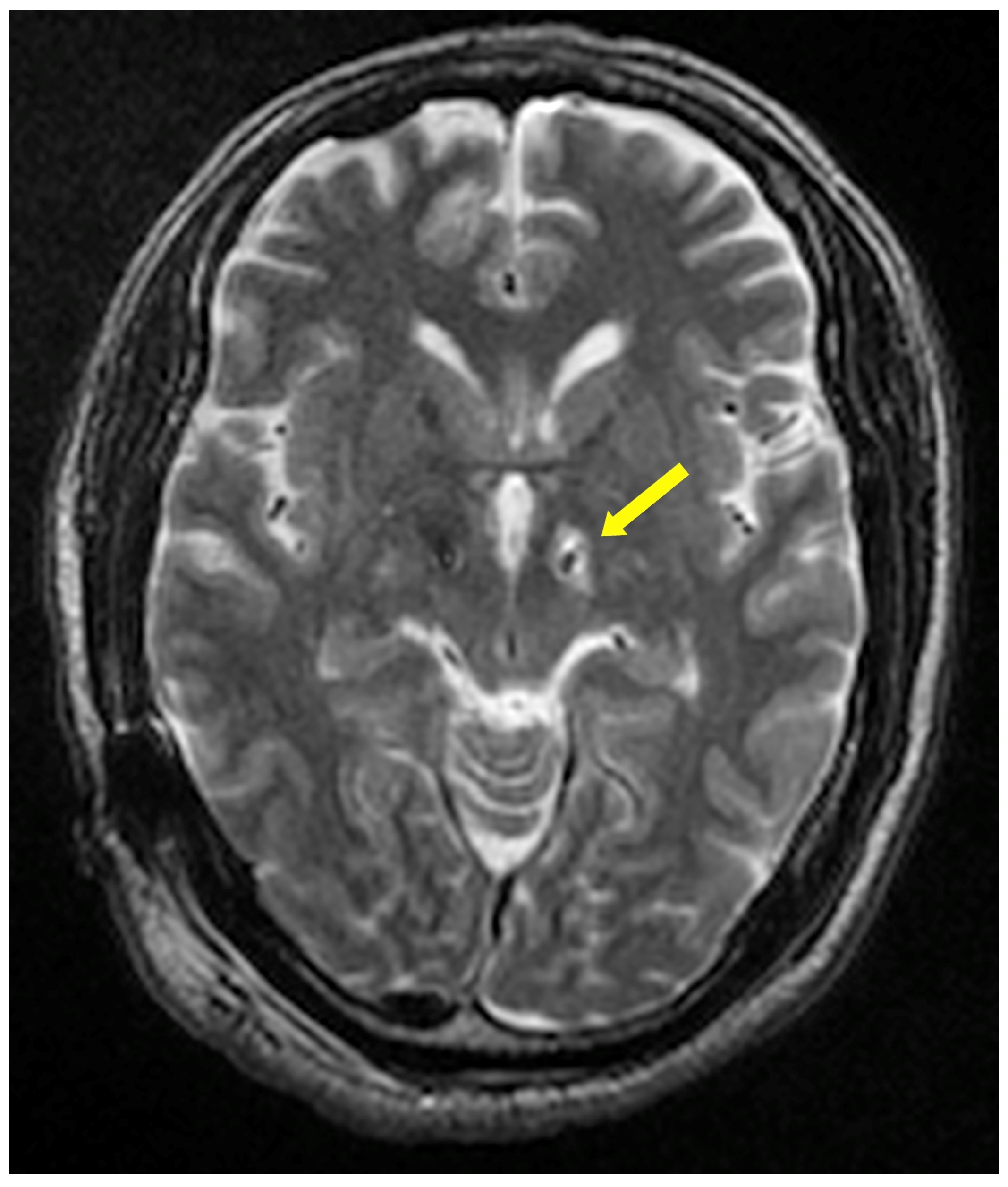Brainsci 12 01447 g002 Brainsci 12 01447 g002