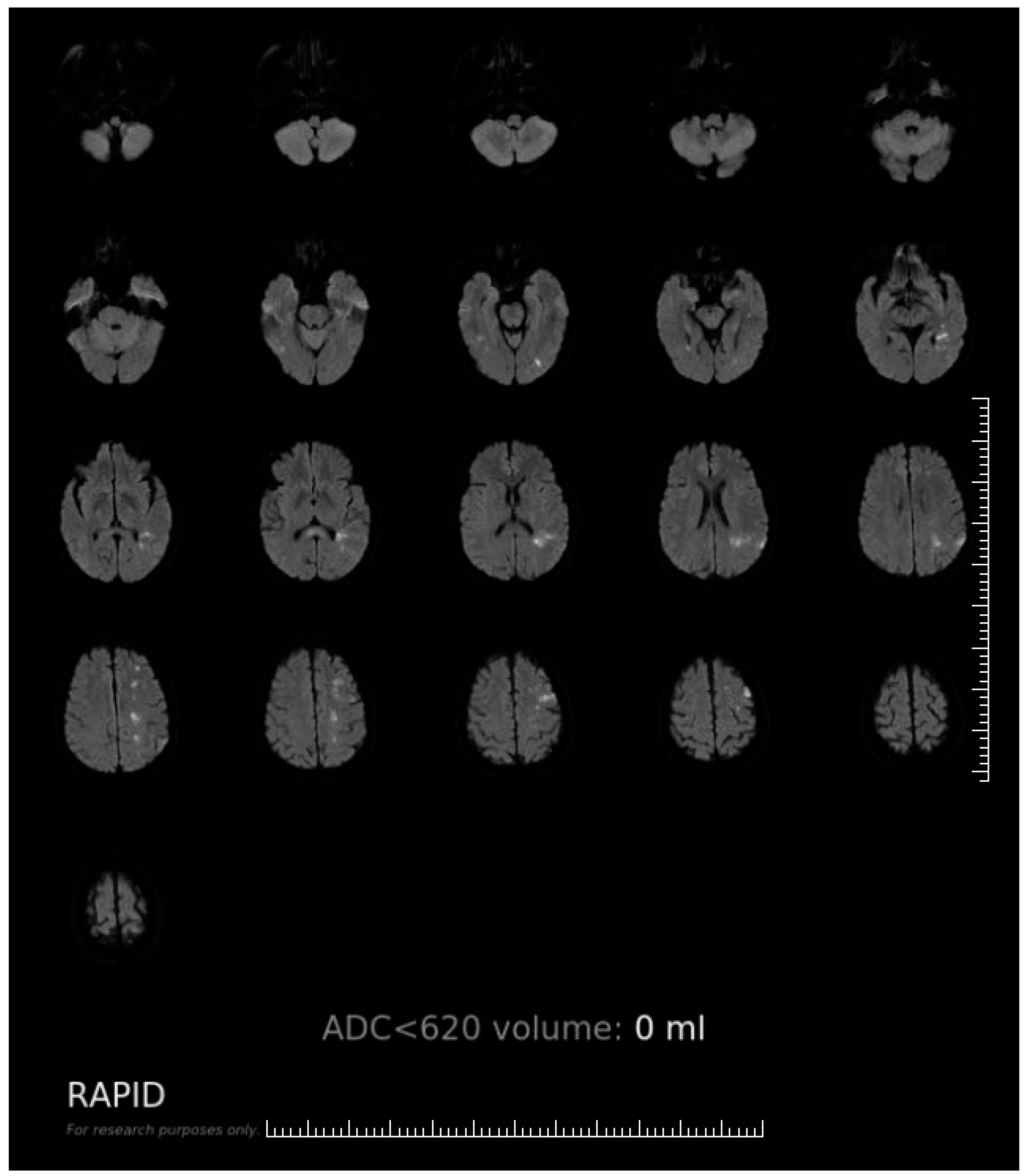 Brainsci 12 01451 g0a1 Brainsci 12 01451 g0a1