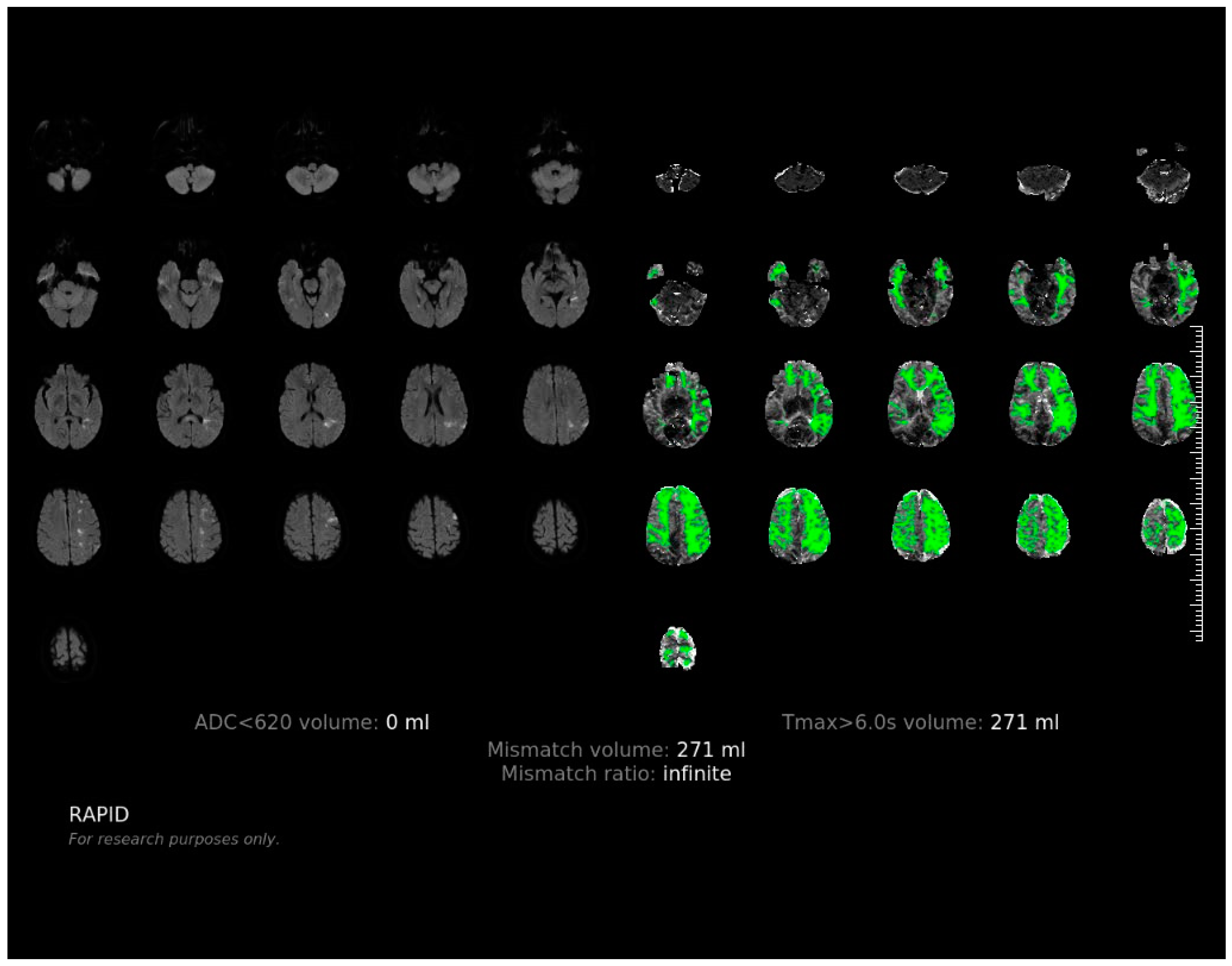 Brainsci 12 01451 g0a3 Brainsci 12 01451 g0a3