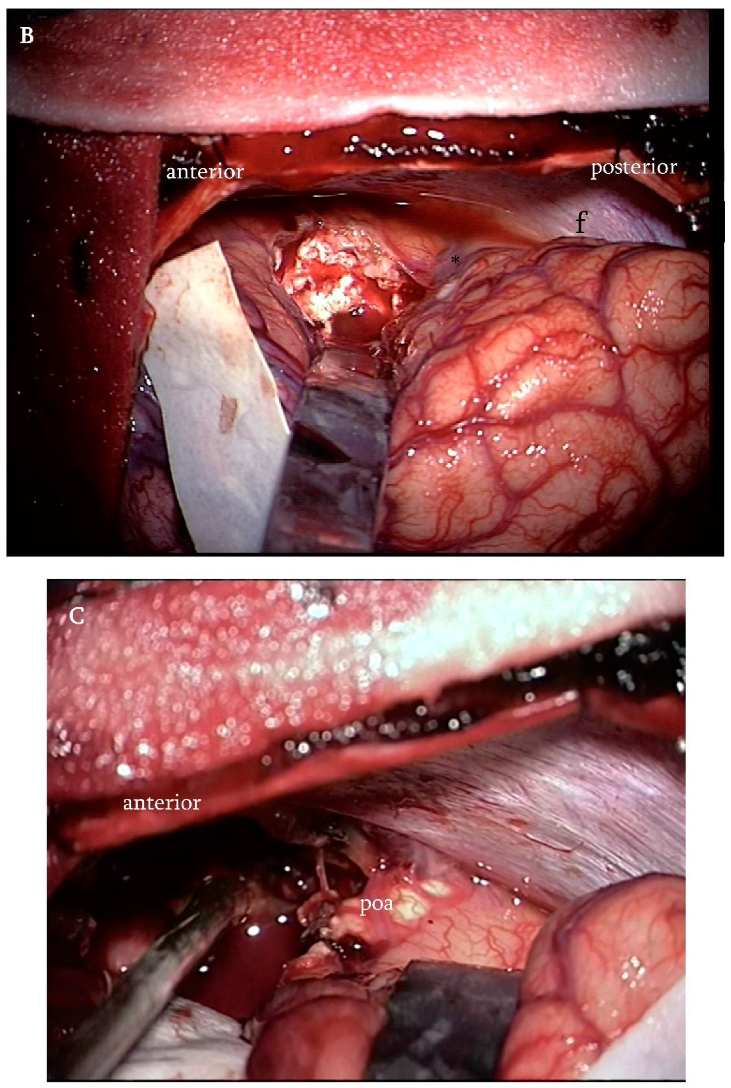 Brainsci 12 01453 g003b