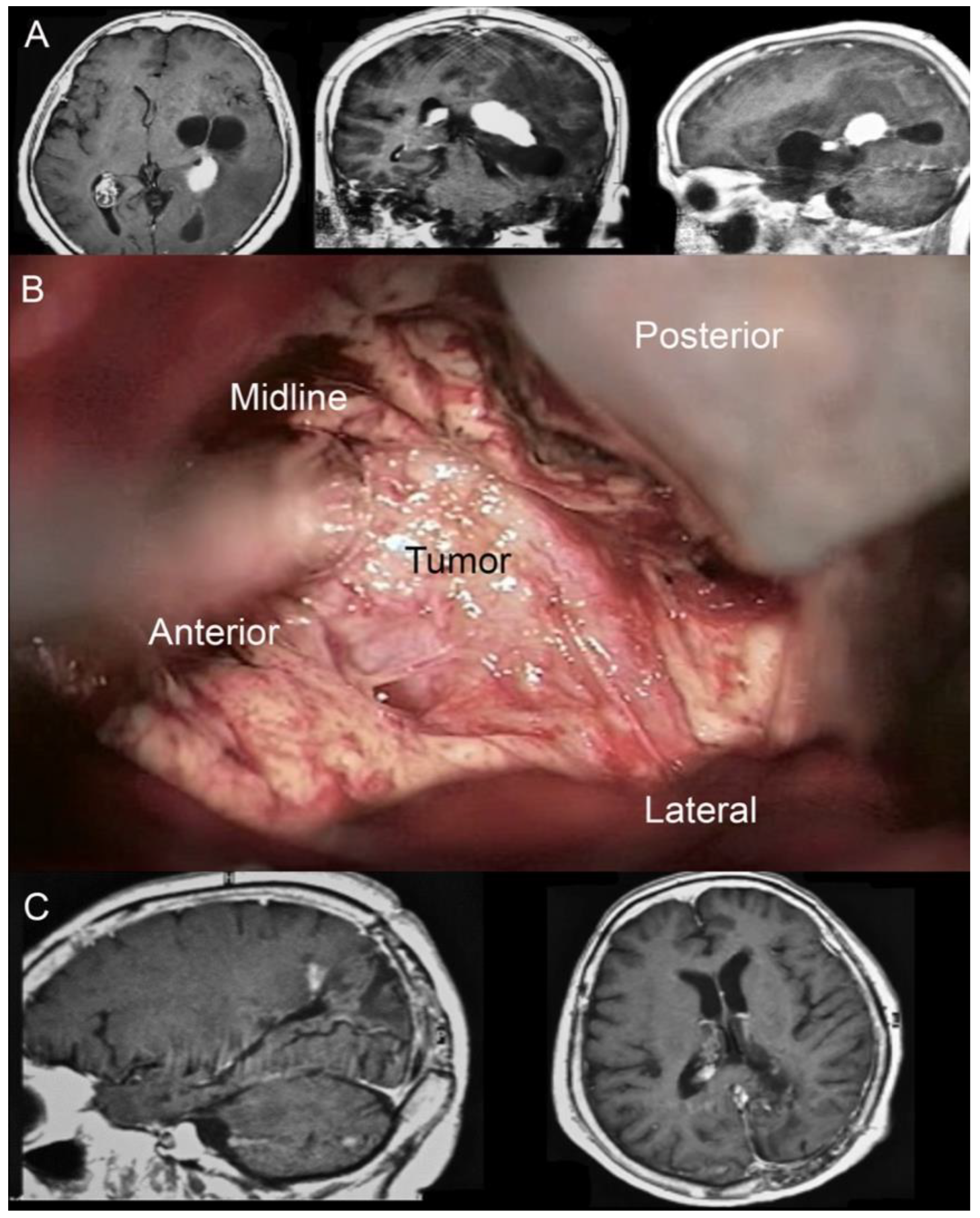Brainsci 12 01453 g004