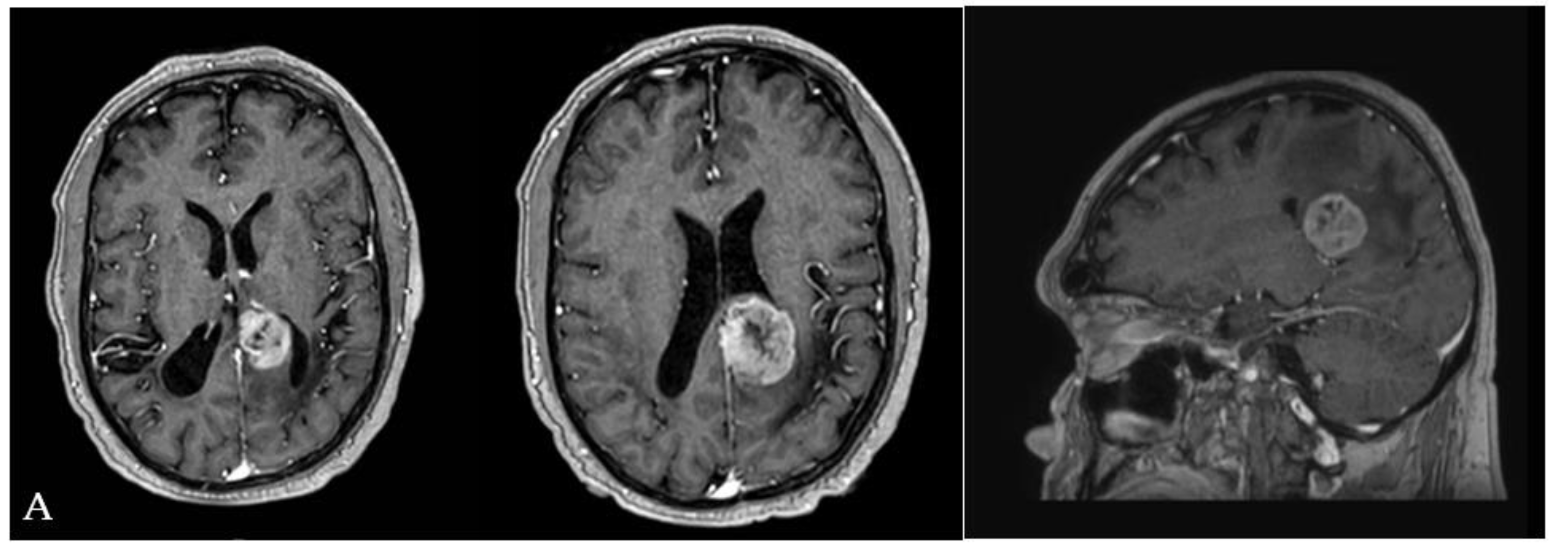 Brainsci 12 01453 g005a