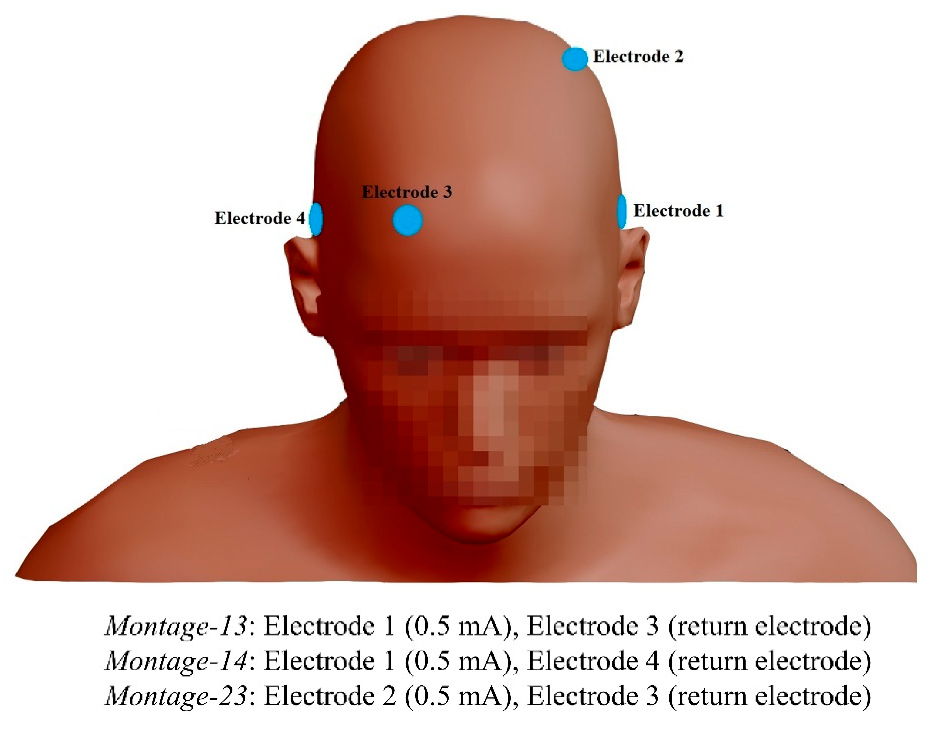 Brainsci 12 01455 g002 Brainsci 12 01455 g002