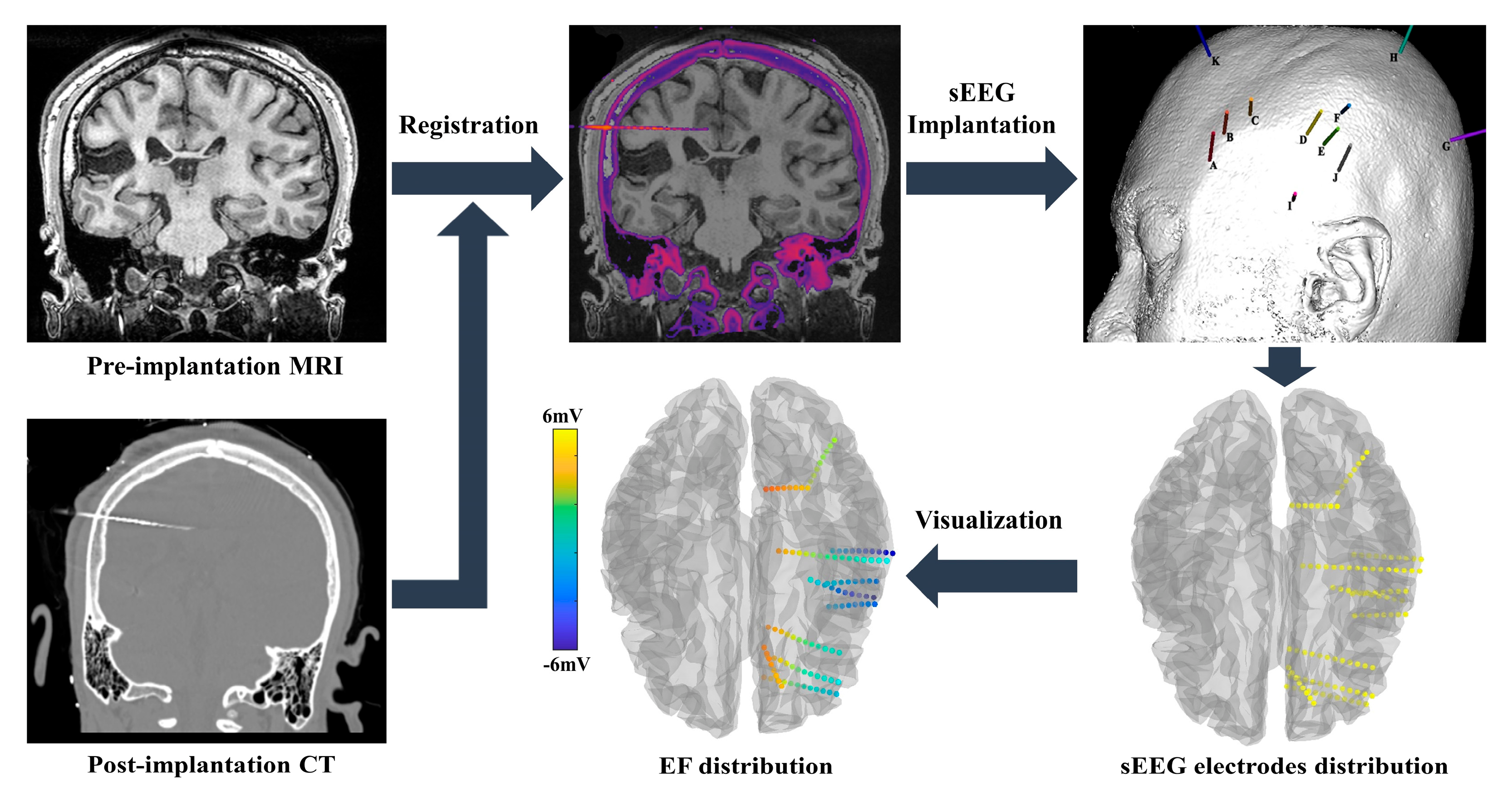 Brainsci 12 01455 g003 Brainsci 12 01455 g003