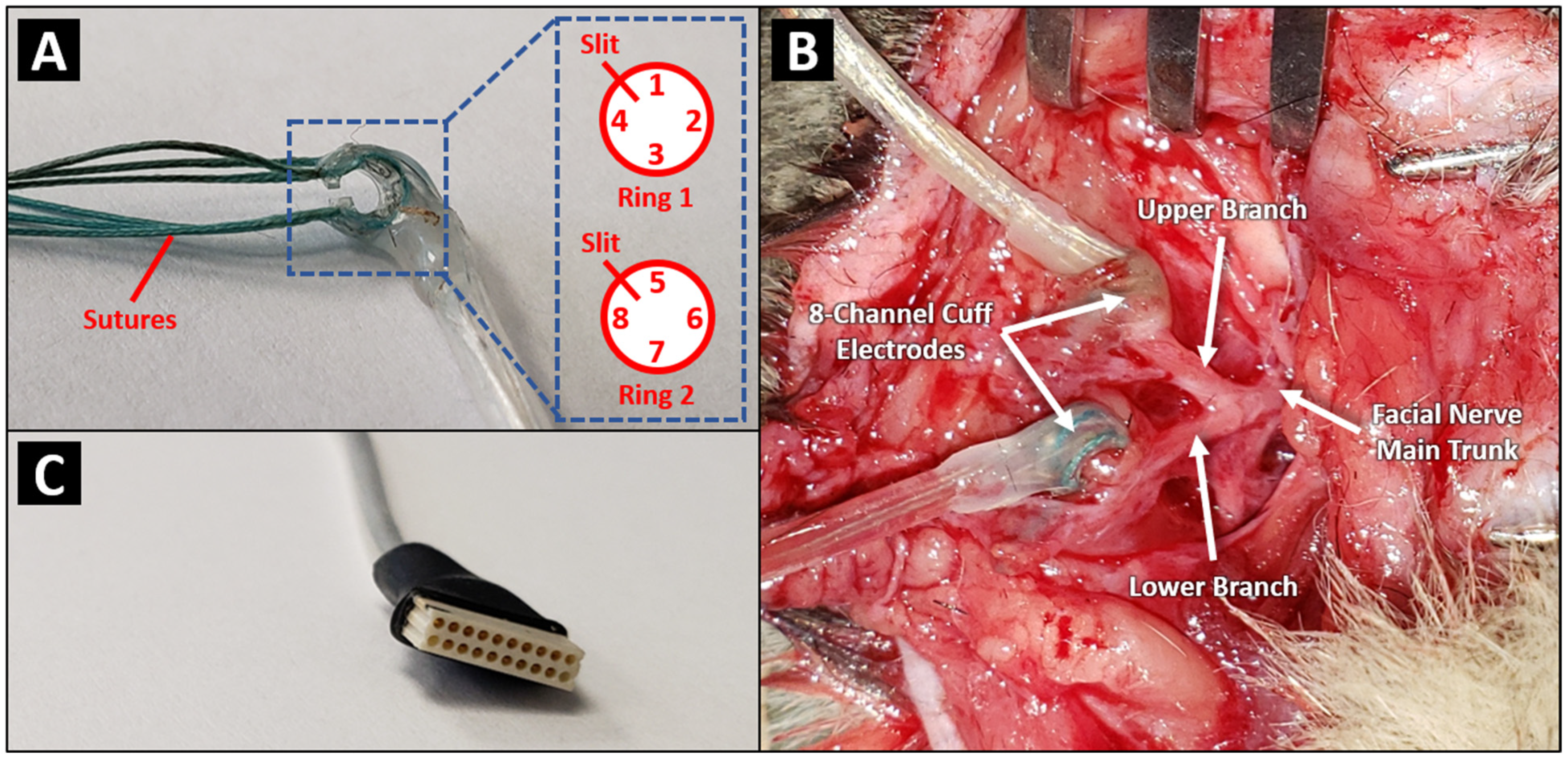 Electrical stimulation found to revitalize muscle perfusion caused