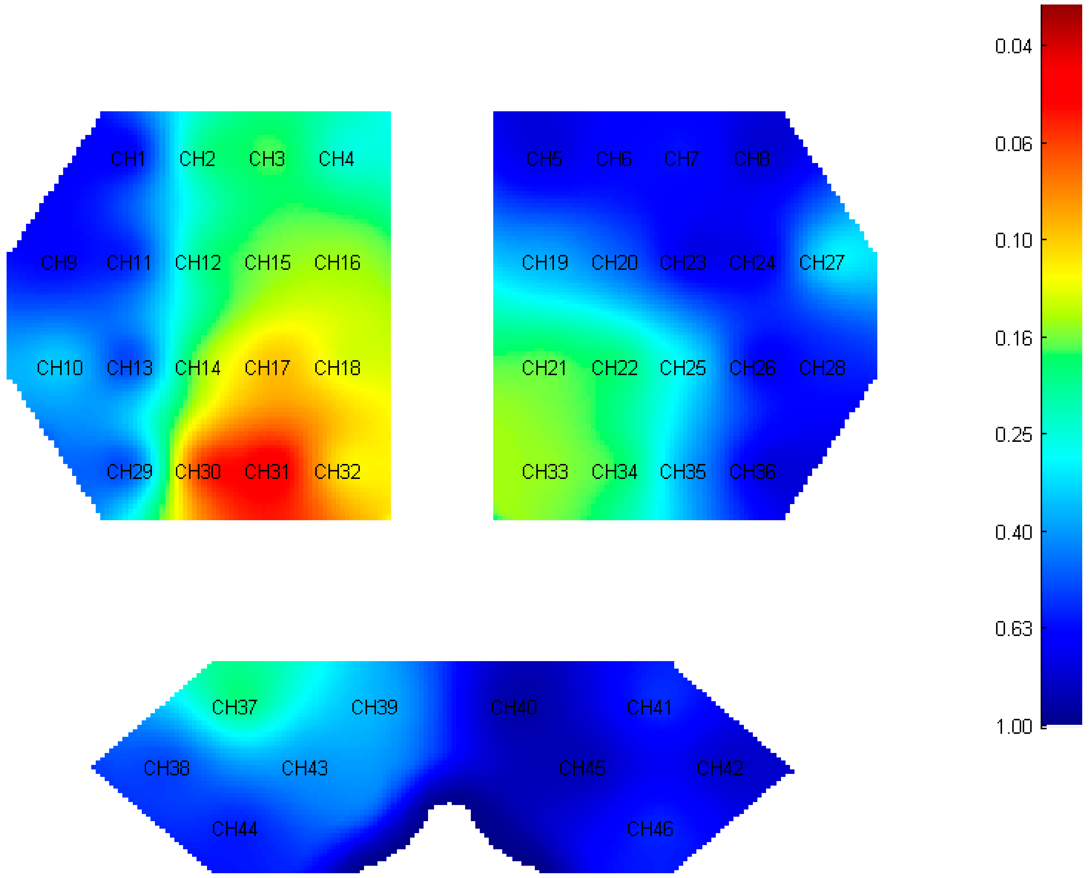 Brainsci 12 01479 g004 Brainsci 12 01479 g004