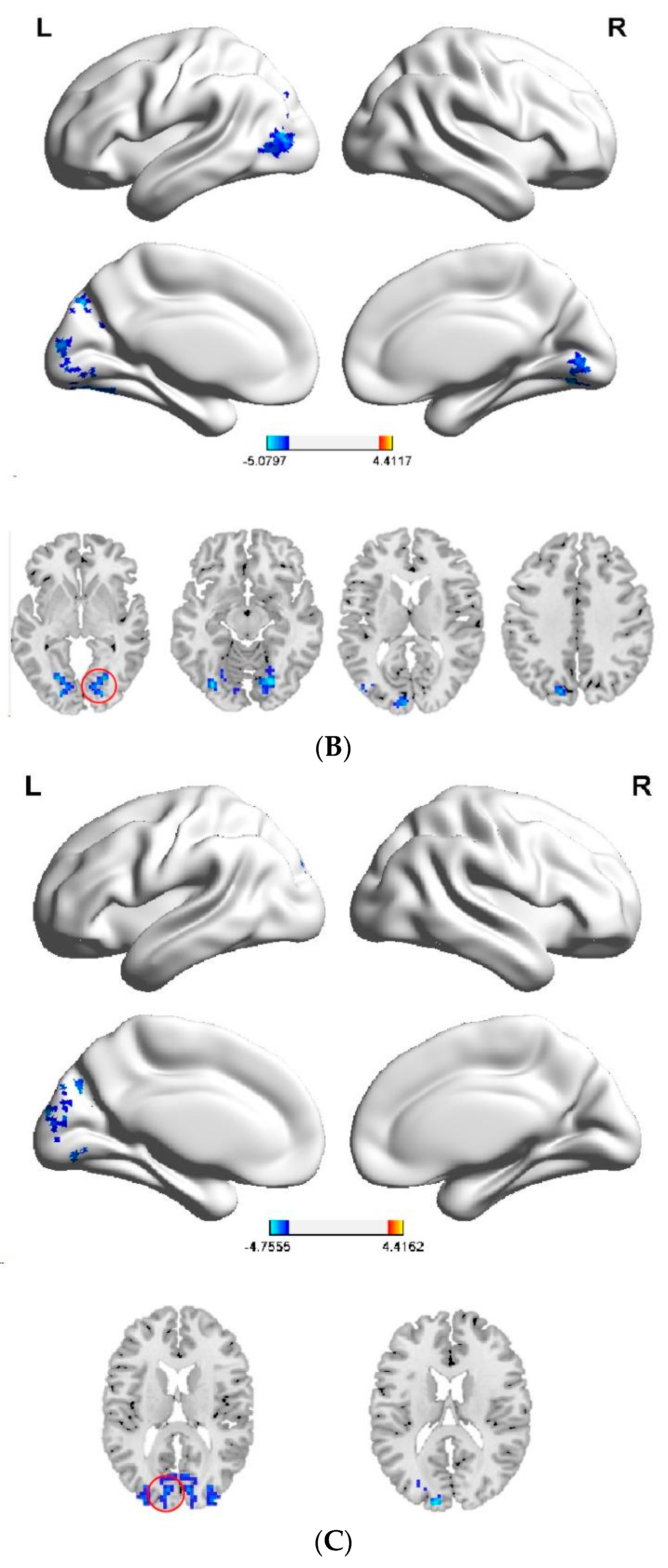 Brainsci 12 01505 g003b Brainsci 12 01505 g003b