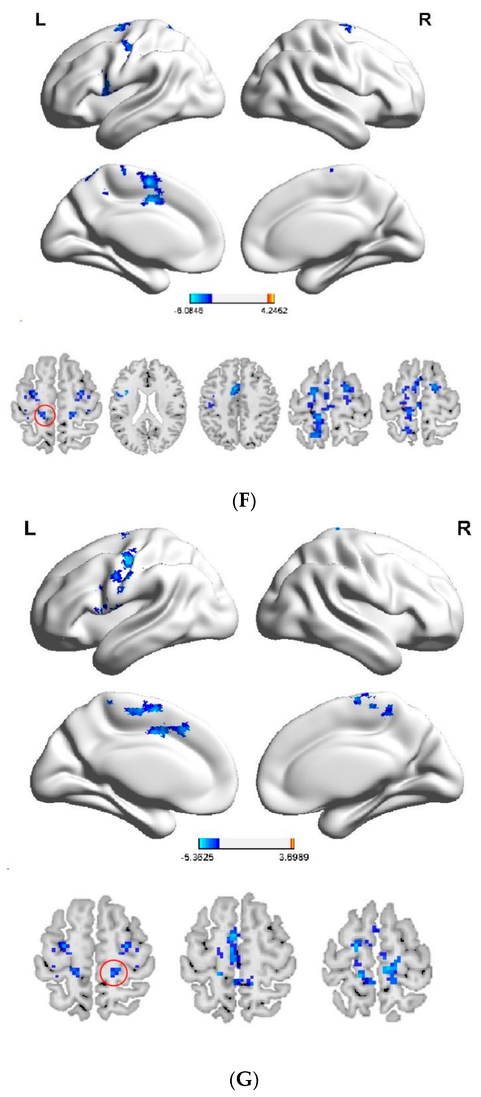 Brainsci 12 01505 g003d Brainsci 12 01505 g003d