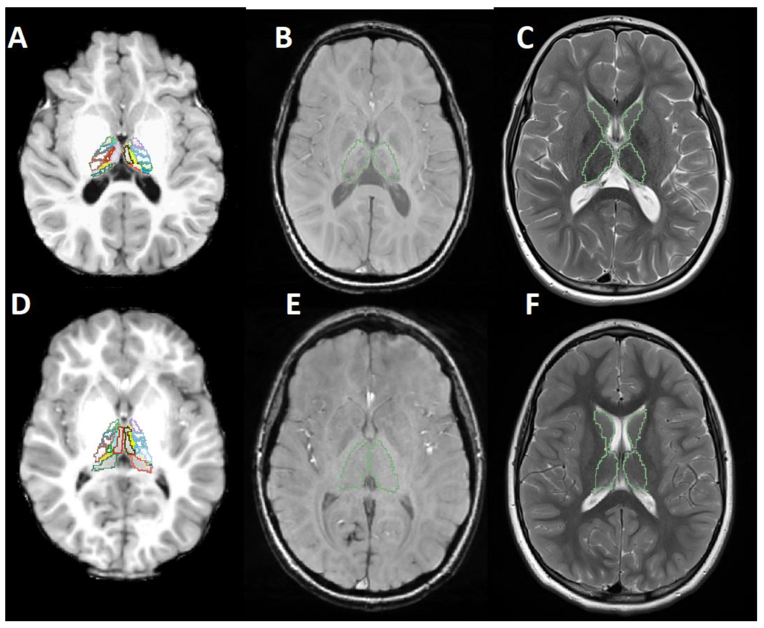 Brainsci 12 01522 g001 Brainsci 12 01522 g001