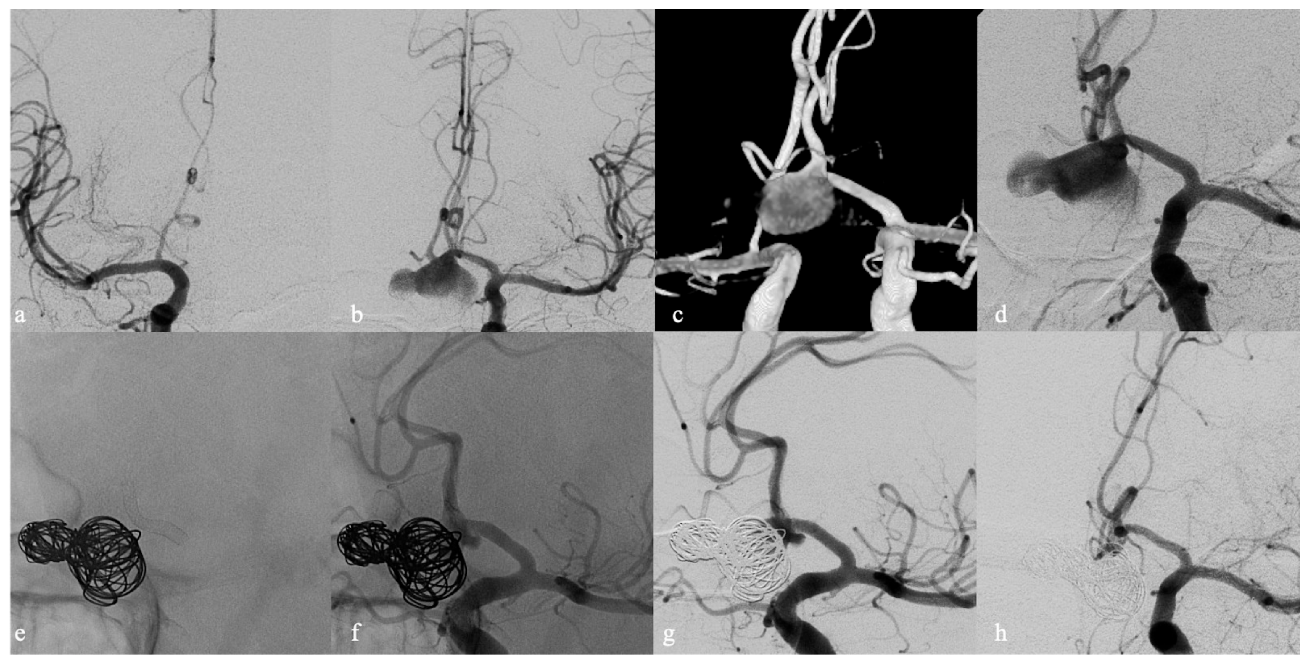 Brainsci 12 01524 g003 Brainsci 12 01524 g003