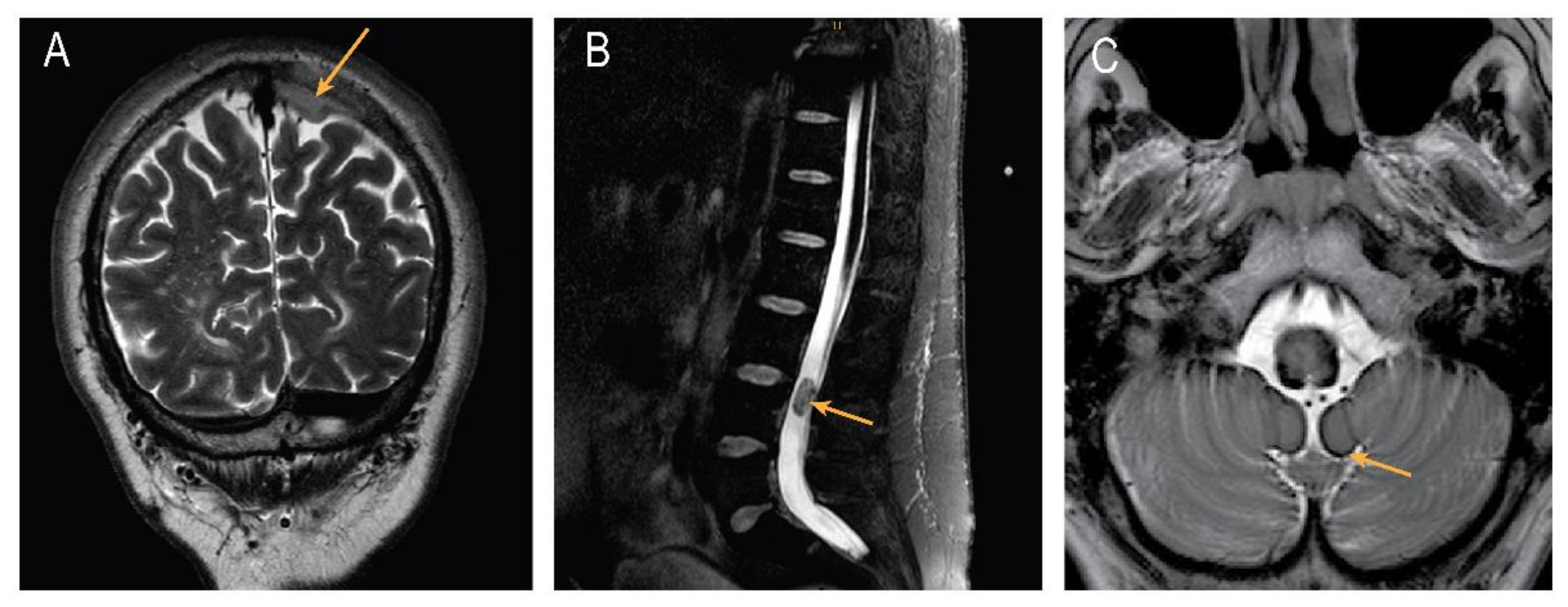 Brainsci 12 01558 g001
