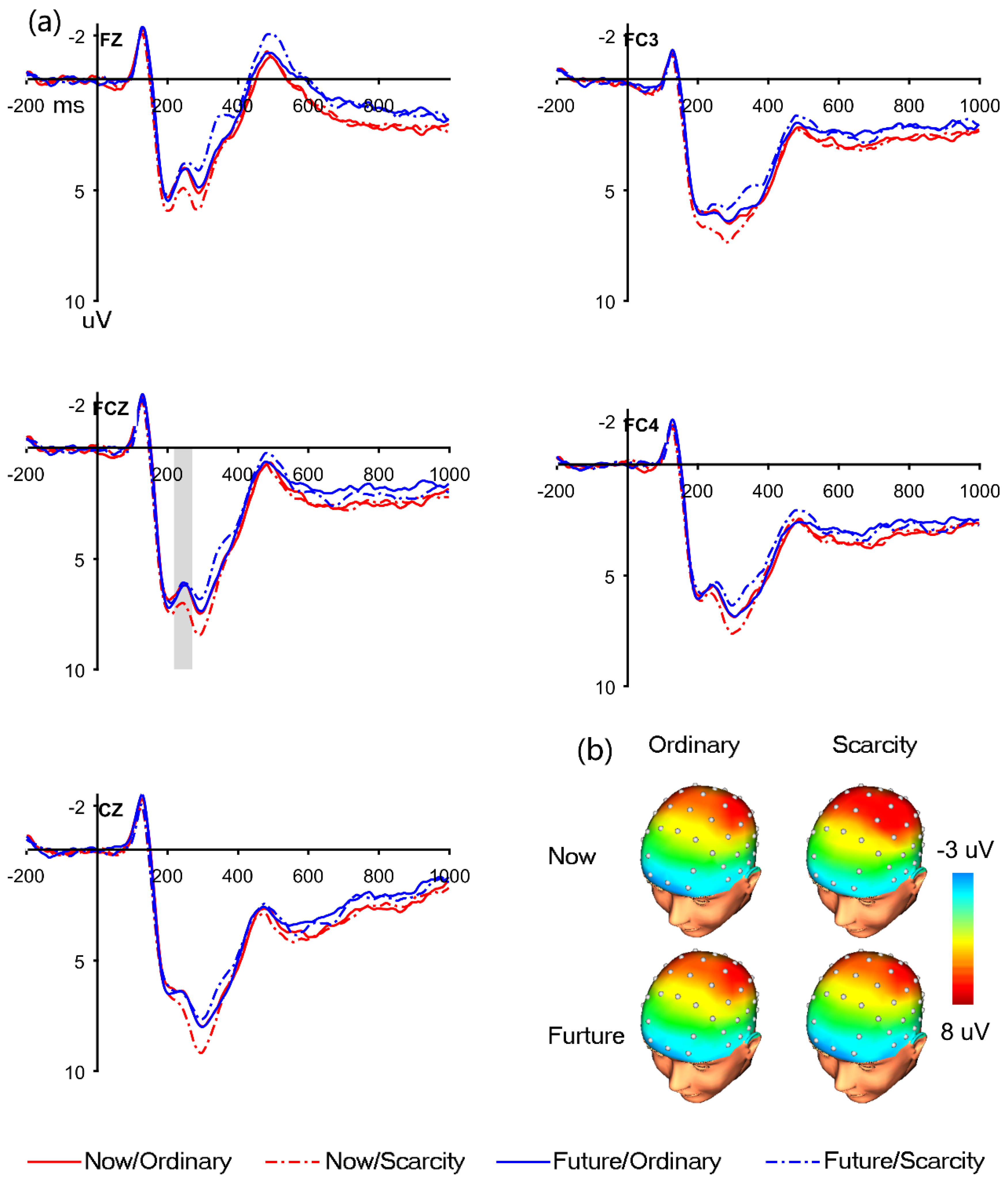 Brainsci 12 01560 g002 Brainsci 12 01560 g002