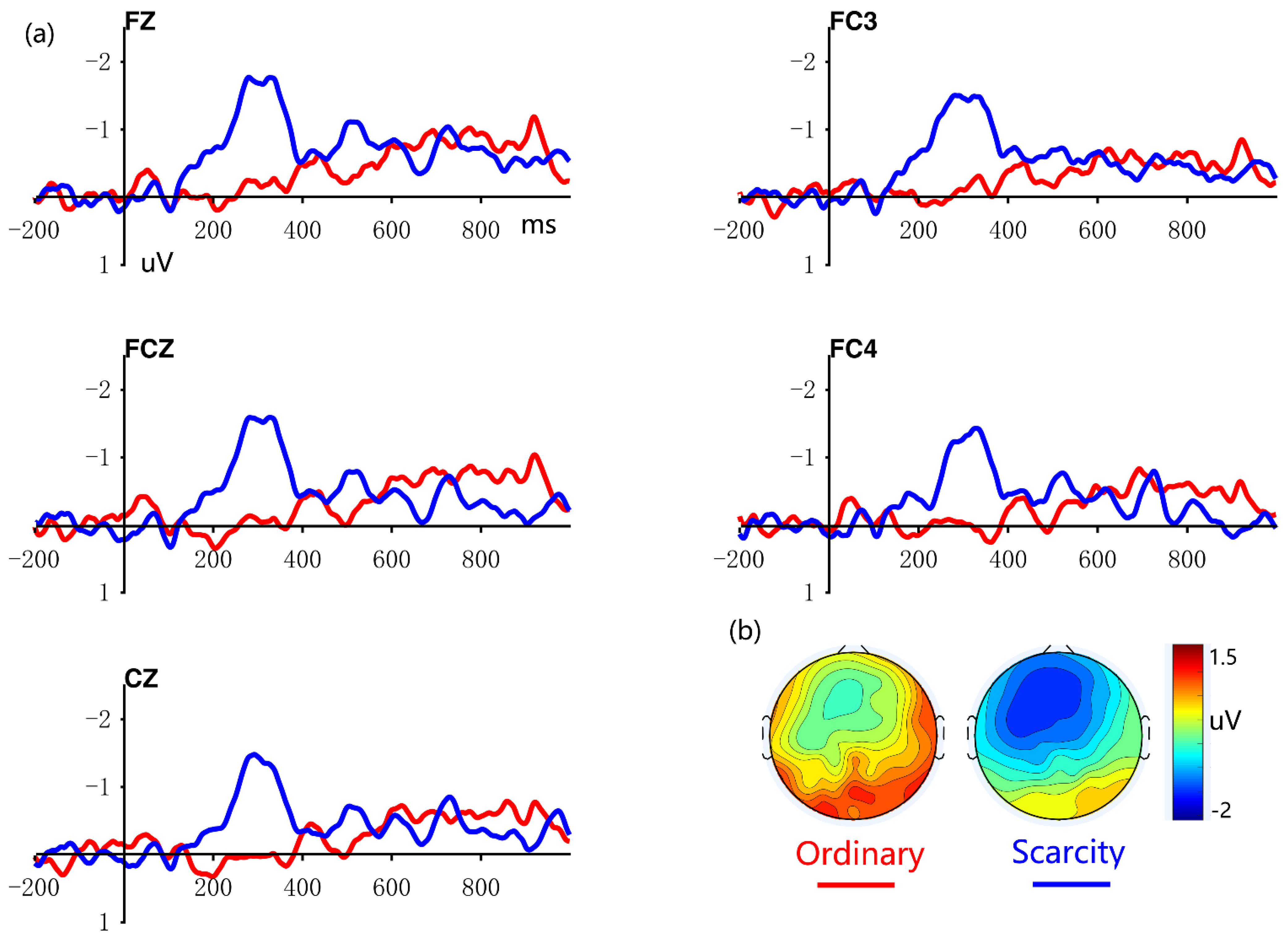 Brainsci 12 01560 g003 Brainsci 12 01560 g003