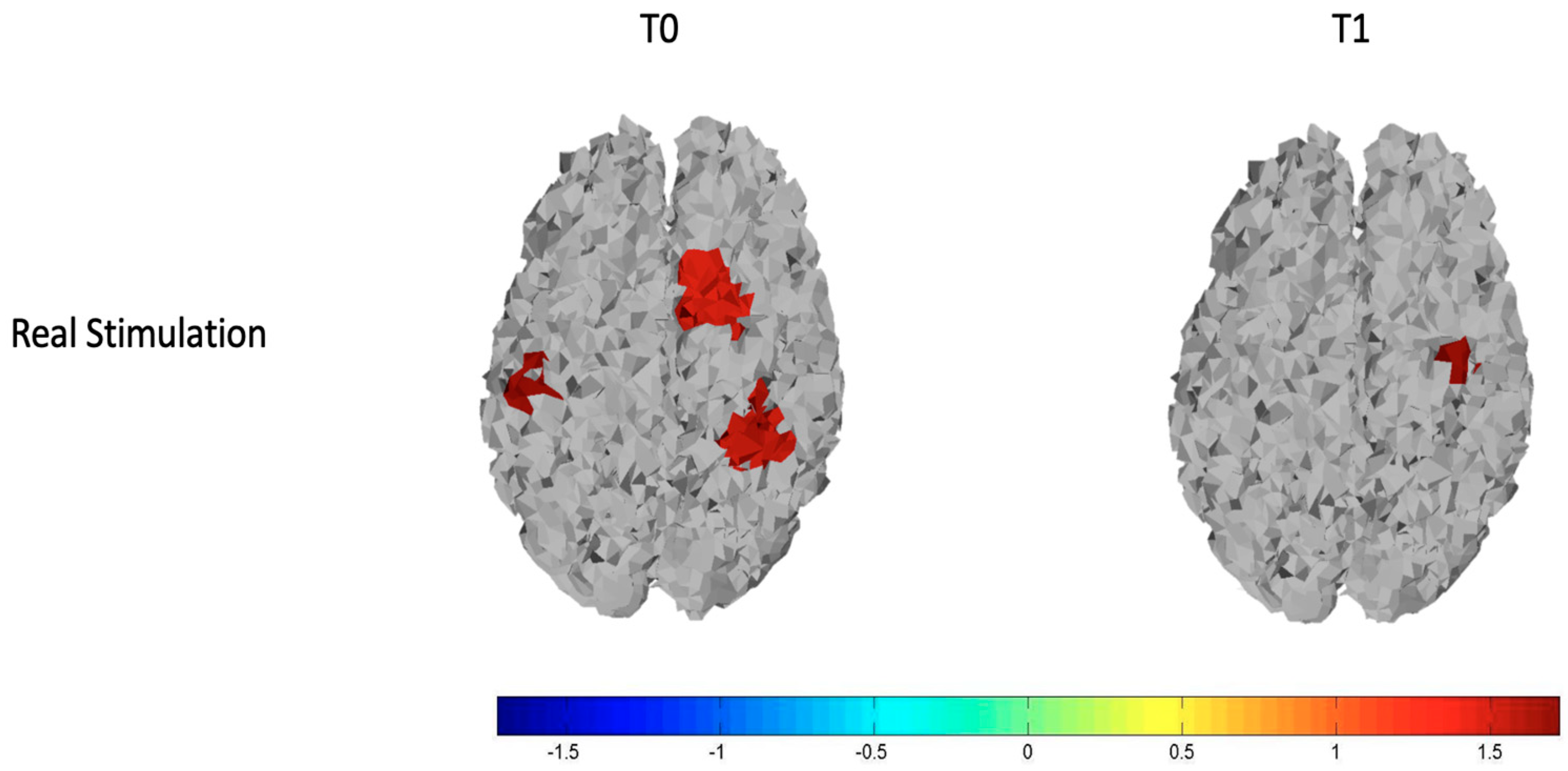 Brainsci 12 01569 g005 Brainsci 12 01569 g005