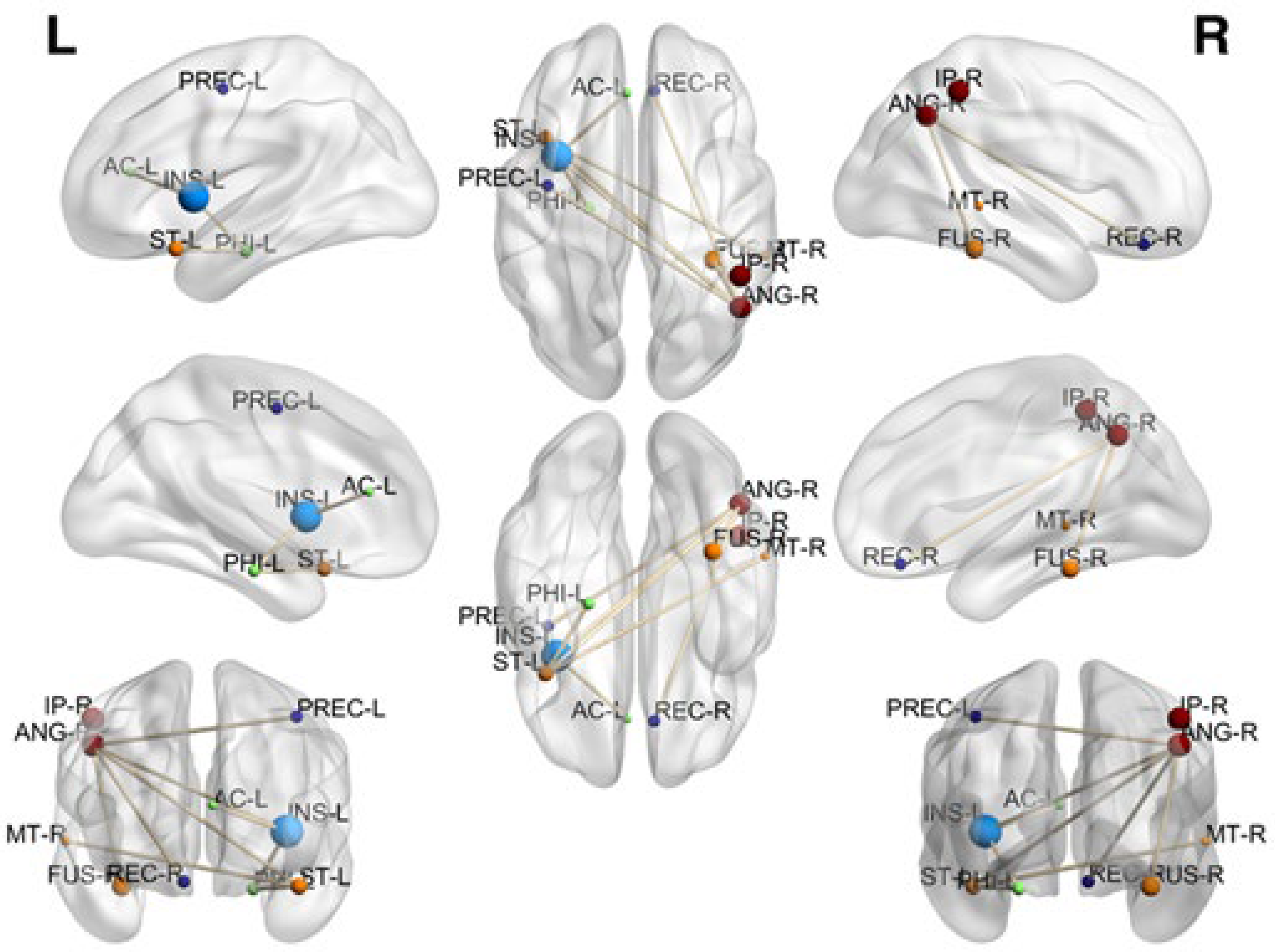 Brainsci 12 01574 g002