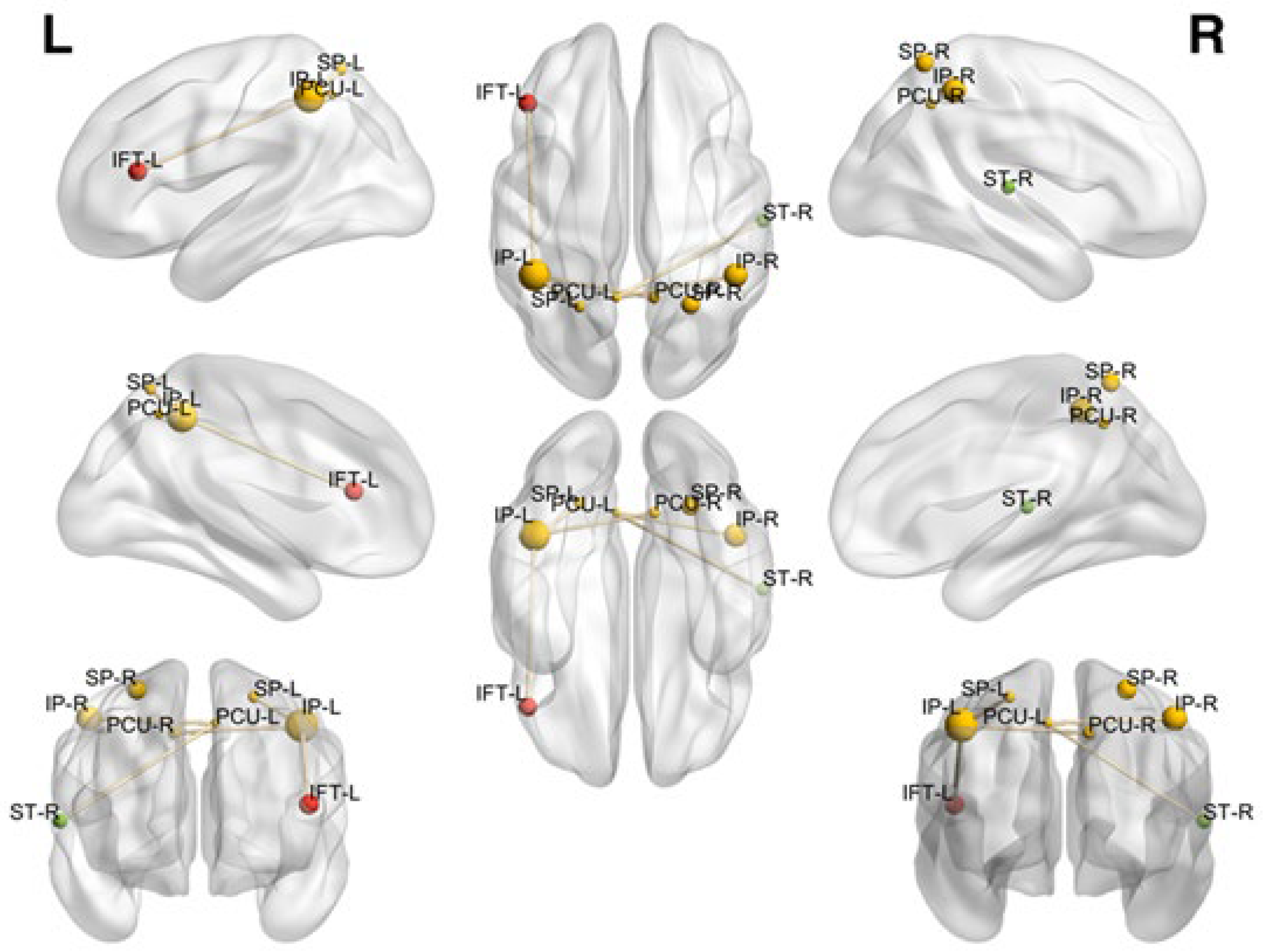 Brainsci 12 01574 g003