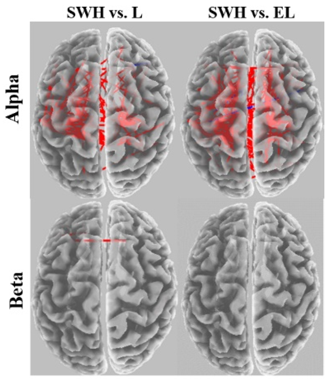 Brainsci 12 01575 g011 Brainsci 12 01575 g011