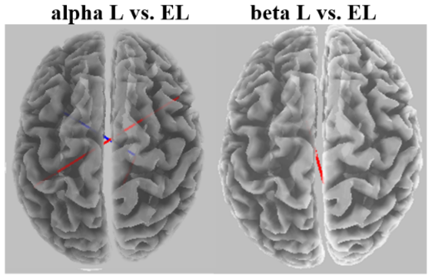 Brainsci 12 01575 g012 Brainsci 12 01575 g012