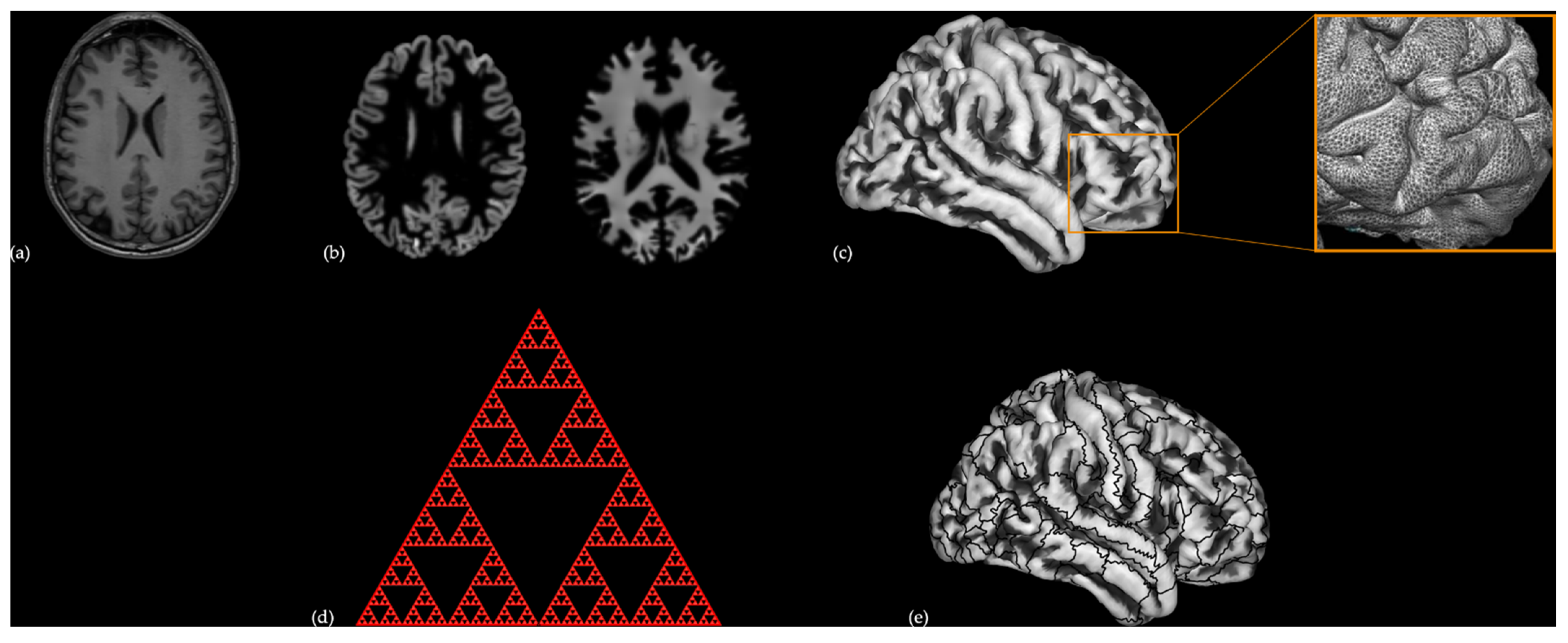 Brain Sciences Free Full-Text Surface-Based Cortical Measures in Multimodal Association Brain Regions Predict Chess Expertise pic pic