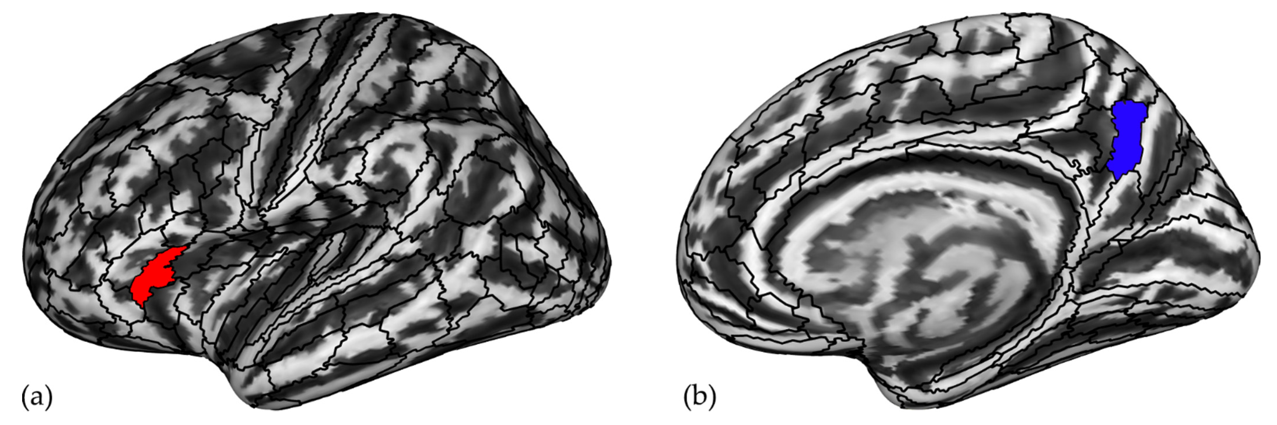 Brainsci 12 01592 g004 Brainsci 12 01592 g004