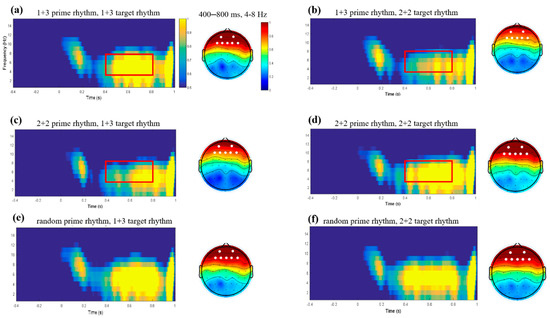 Theta Band (4–8 Hz) Oscillations Reflect Online Processing of Rhythm in ...
