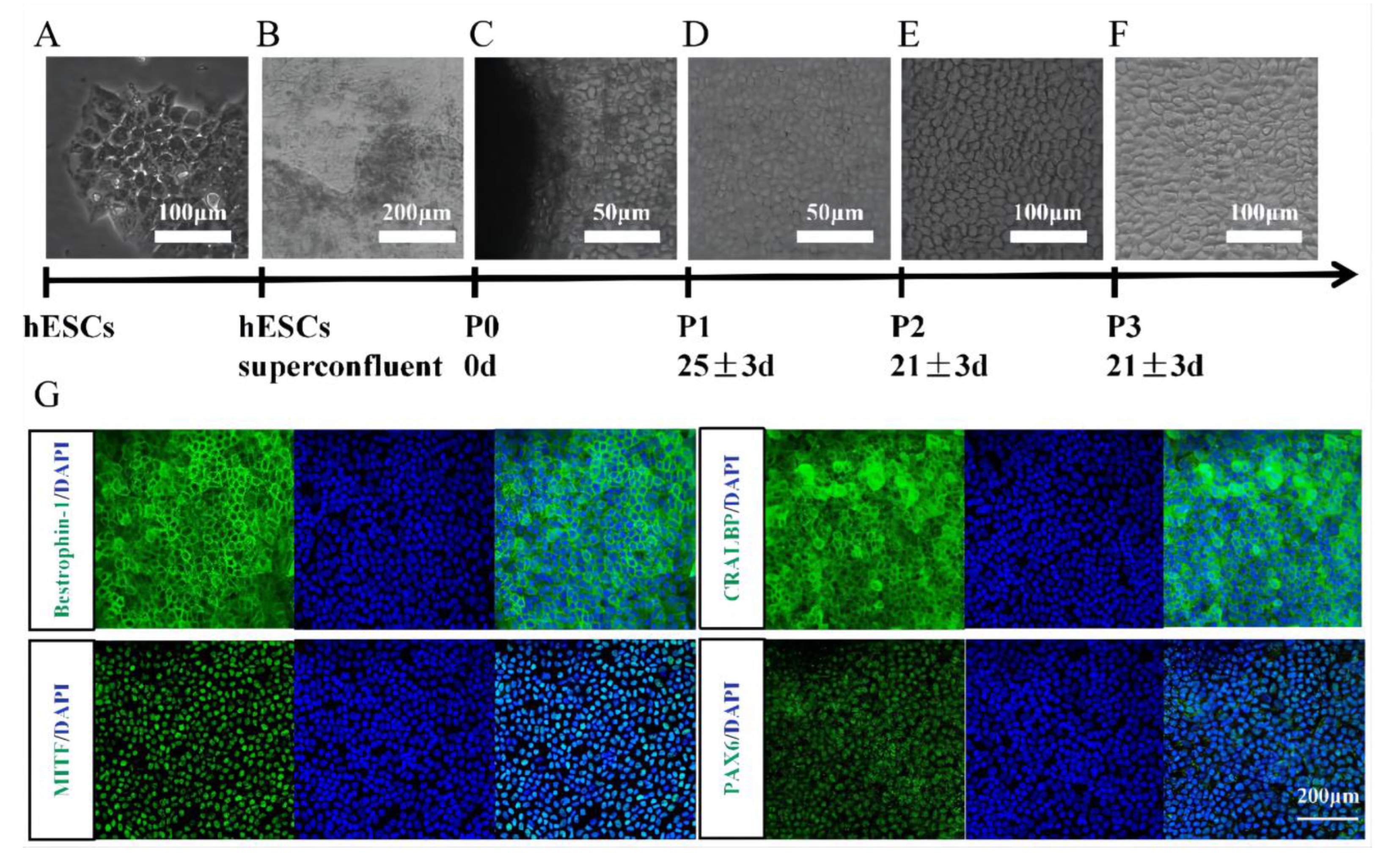 Hydrogels to Support Transplantation of Human Embryonic Stem Cell Derived Retinal Pigment Epithelial Cells