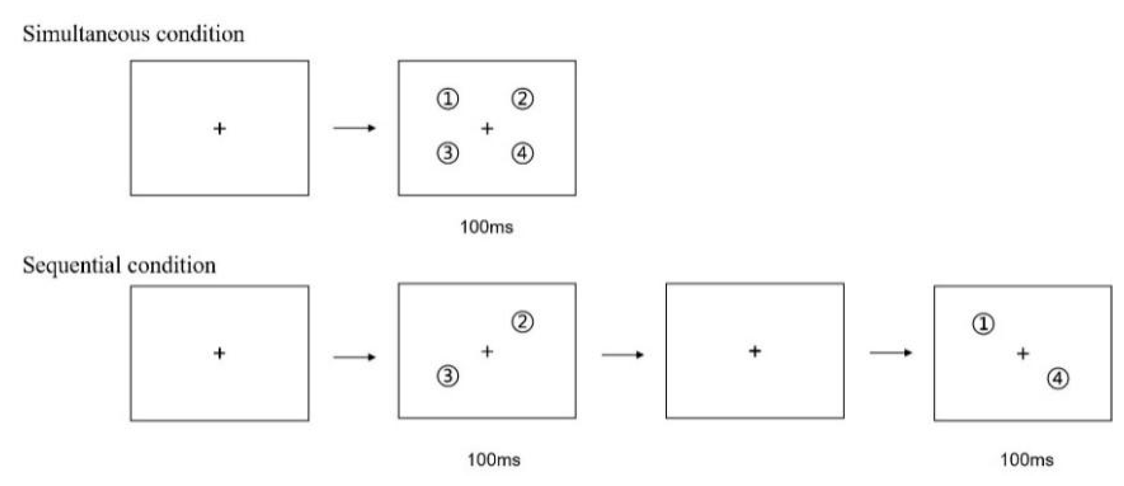 Experimental paradigm of Posner's task.