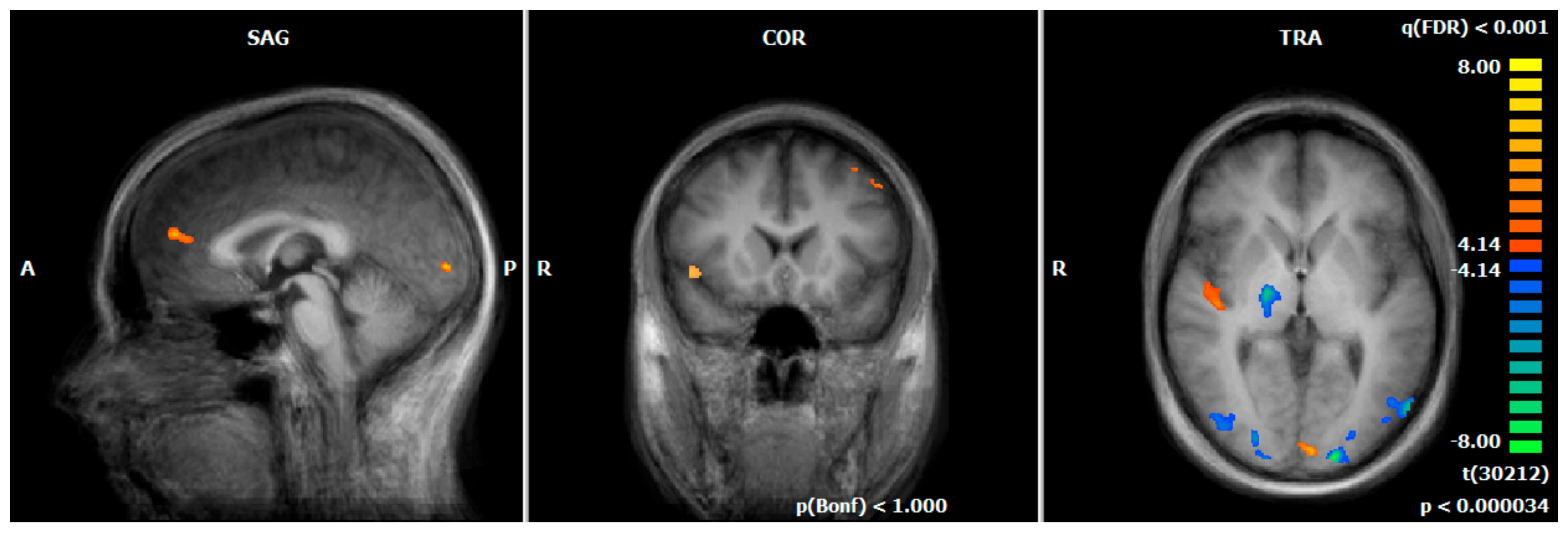 Brainsci 12 01714 g002