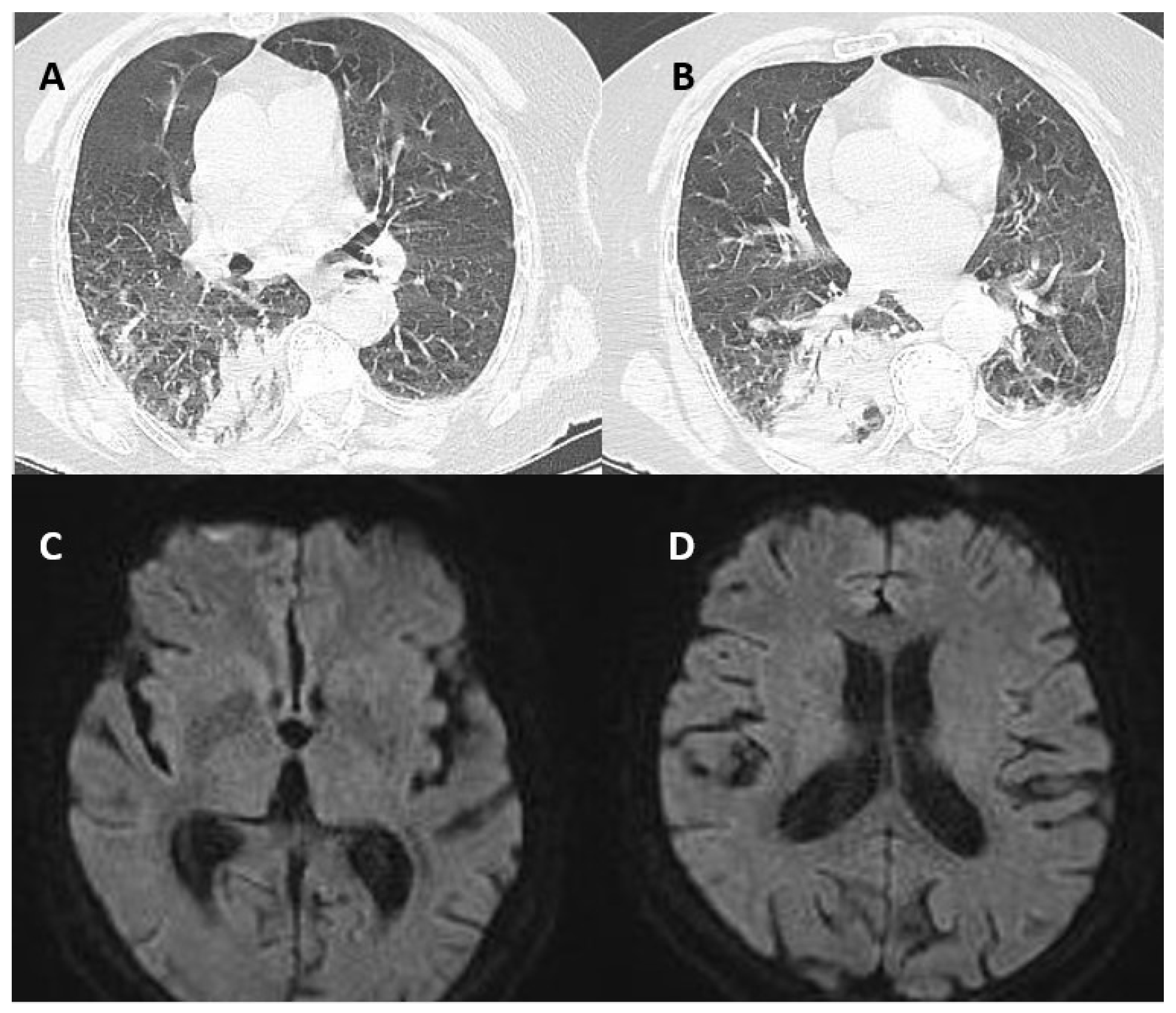 Brainsci 12 01733 g001 Brainsci 12 01733 g001