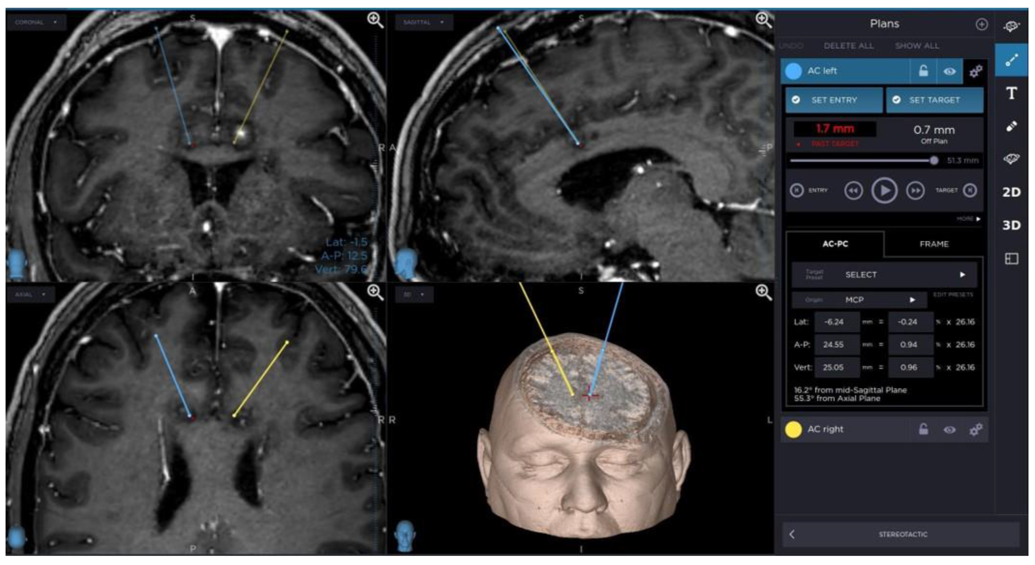 Brainsci 13 00044 g001