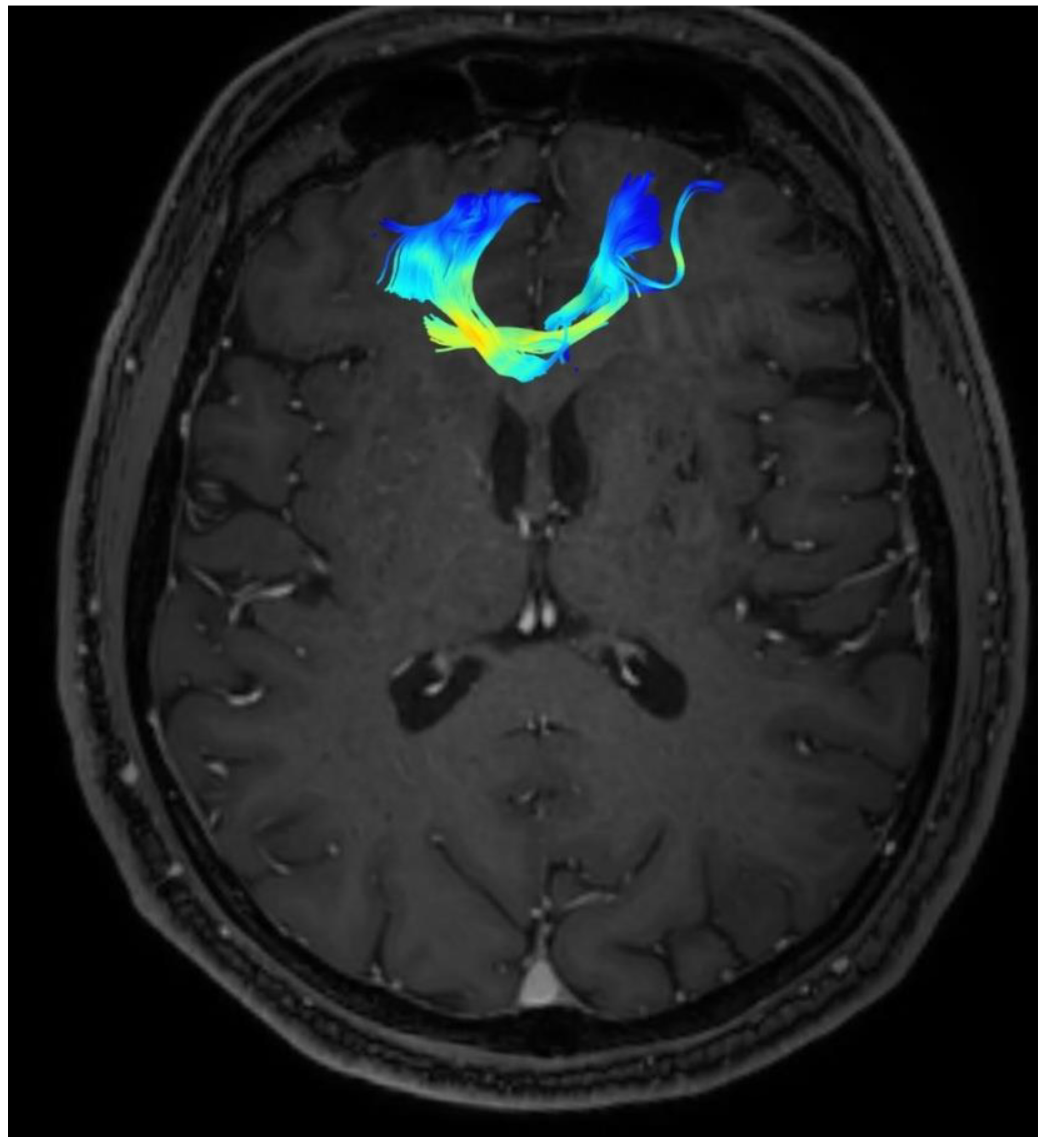 Brainsci 13 00044 g002