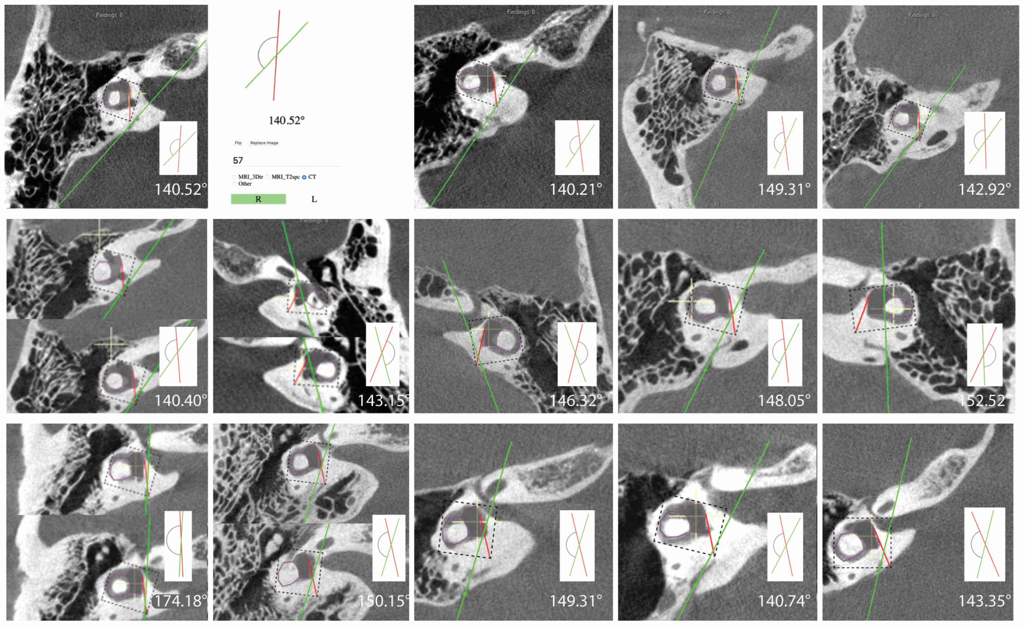 Brainsci 13 00047 g002 Brainsci 13 00047 g002