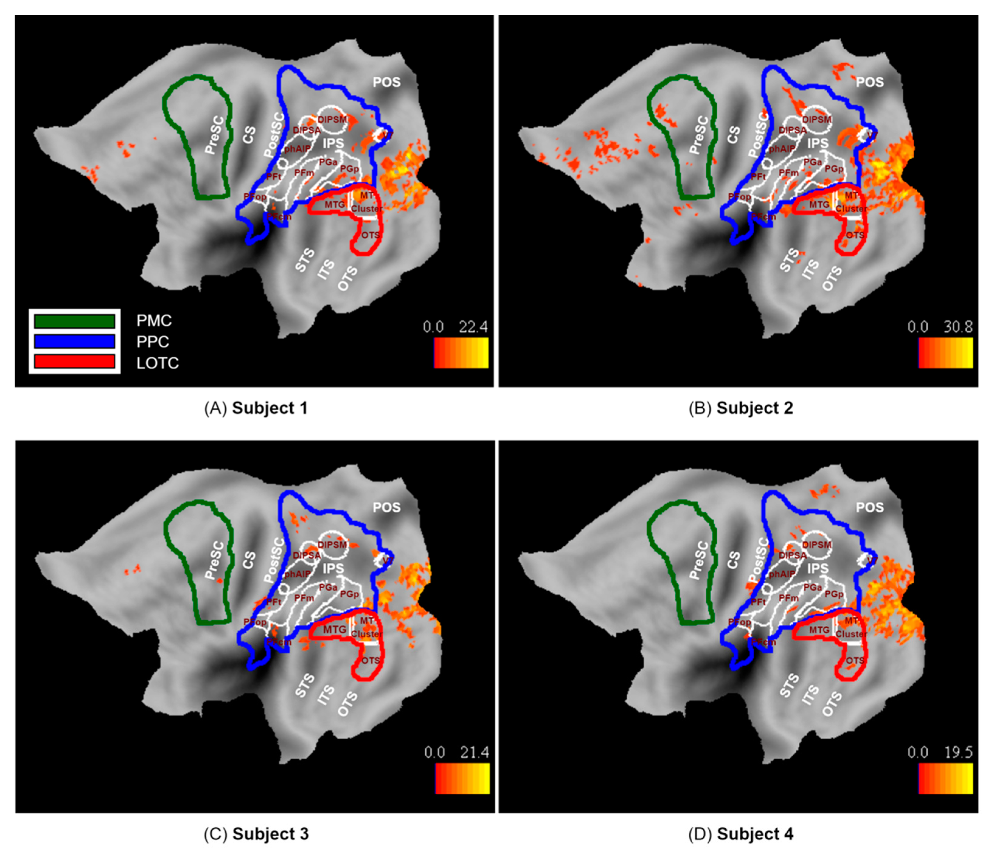 Brainsci 13 00061 g006 Brainsci 13 00061 g006
