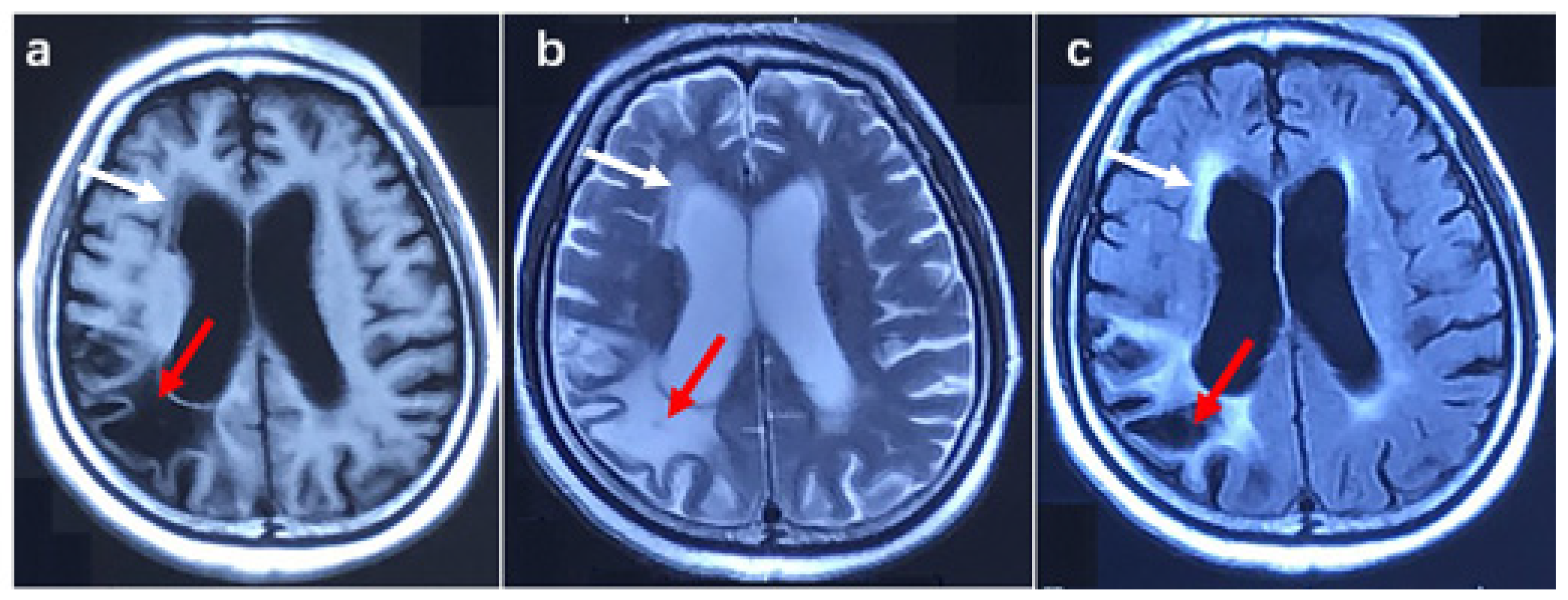 Brainsci 13 00085 g003 Brainsci 13 00085 g003