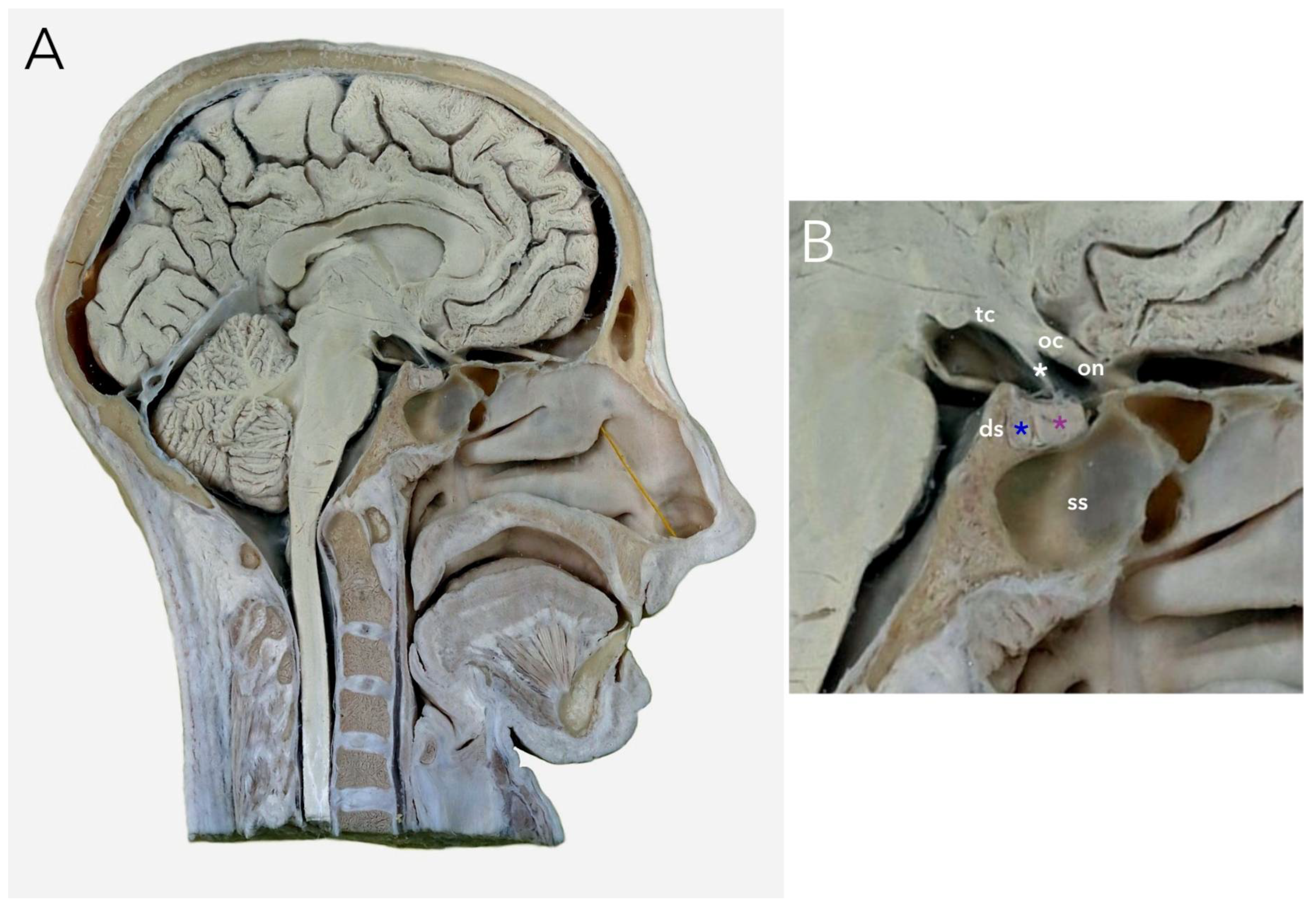 Brainsci 13 00089 g003 Brainsci 13 00089 g003