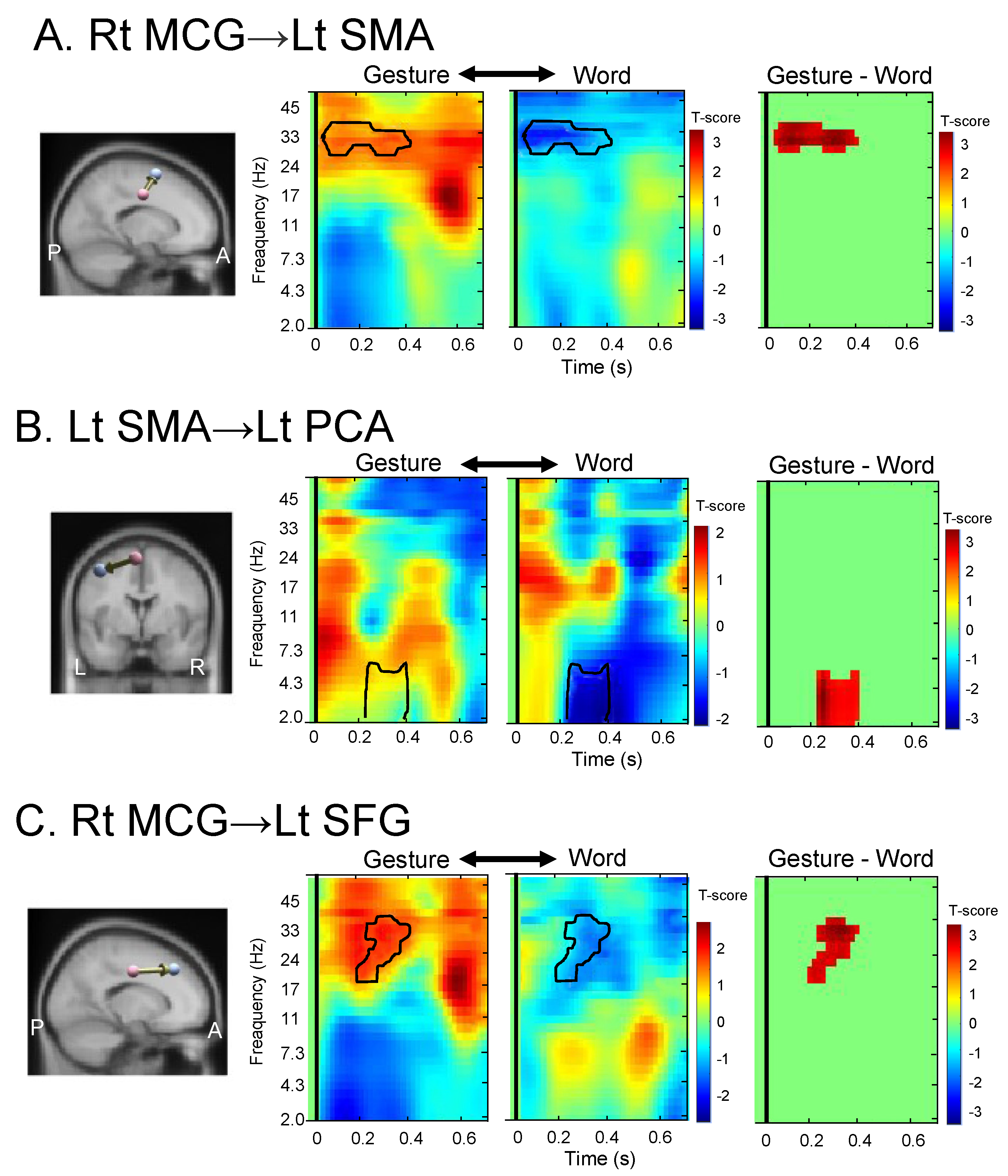 Brainsci 13 00100 g006 Brainsci 13 00100 g006