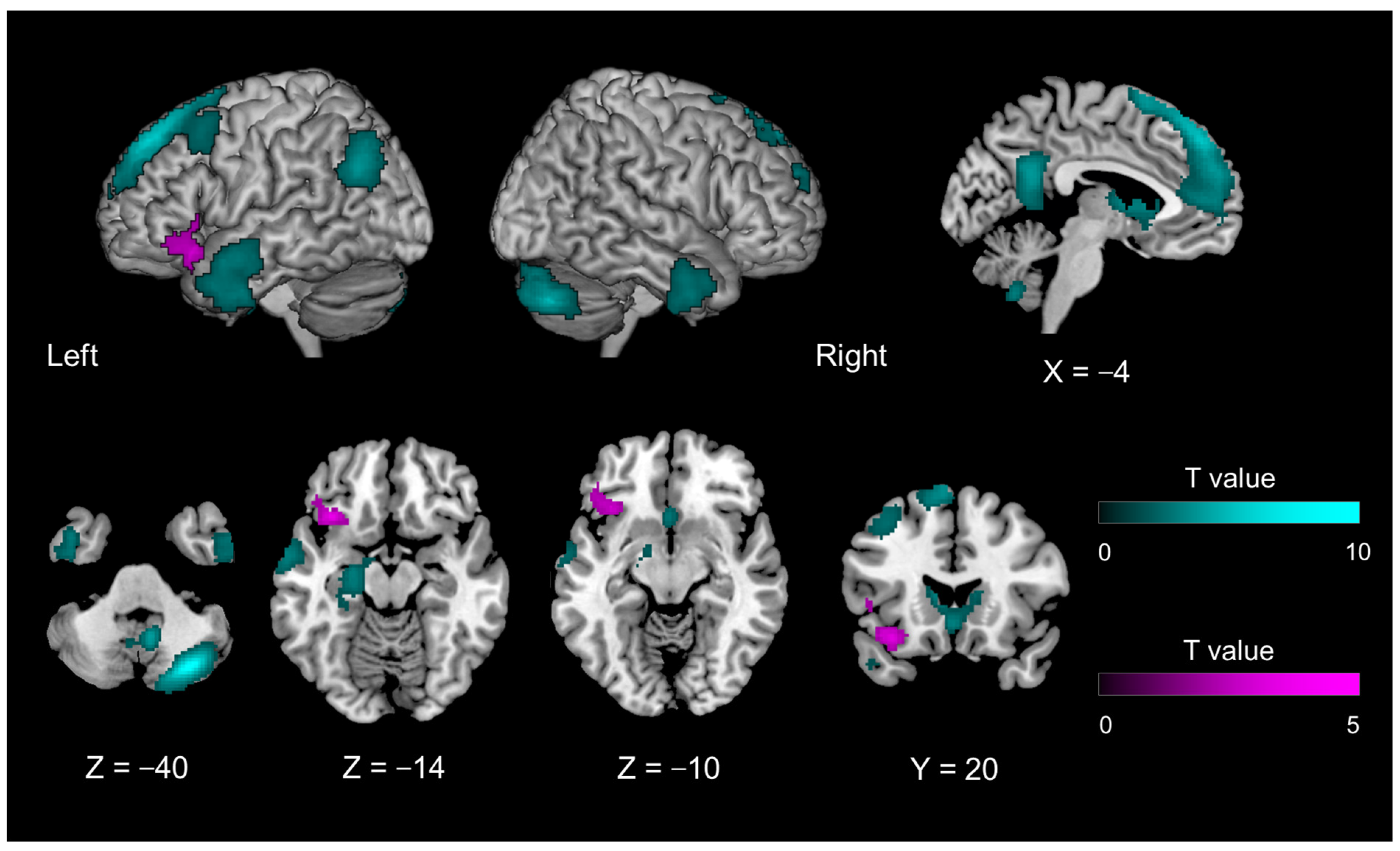 Brainsci 13 00111 g003 Brainsci 13 00111 g003